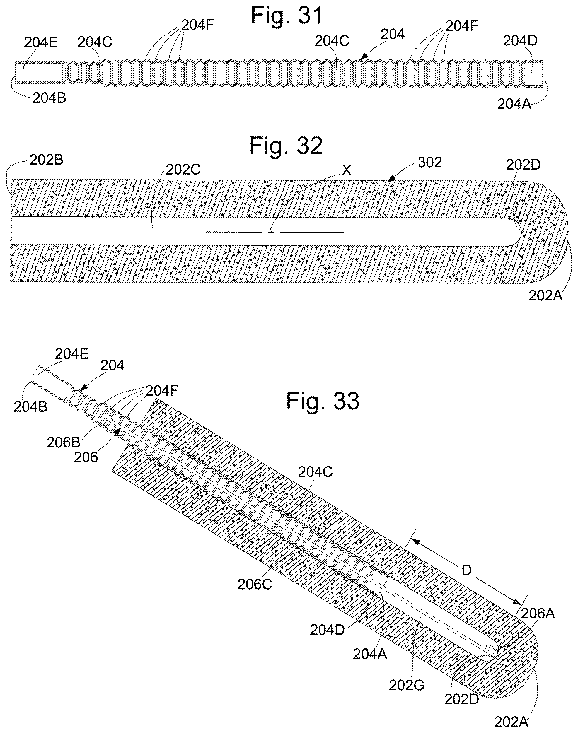 Patent US12472302 Figure 12 – External female catheter system and method of use