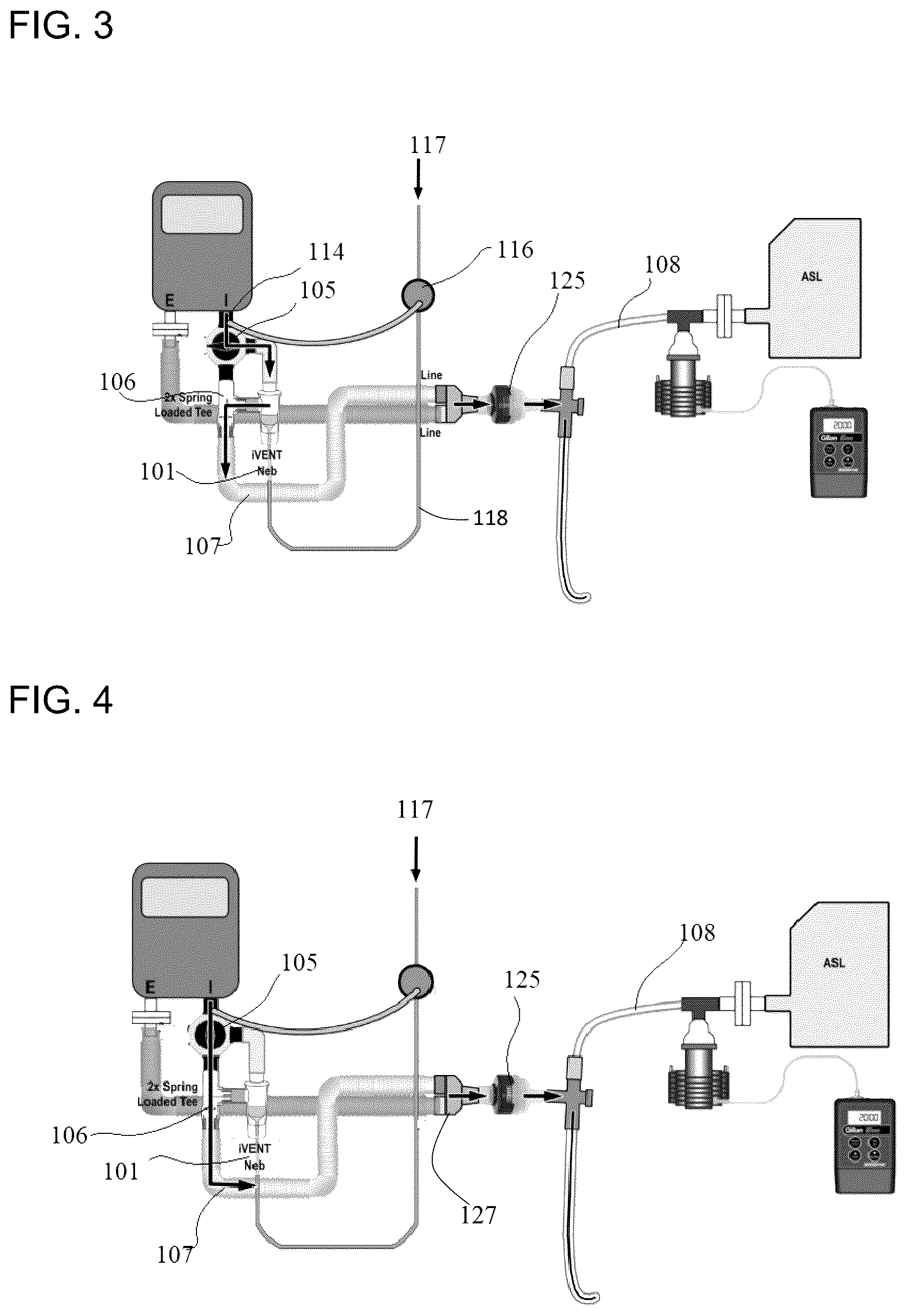 Patent US12472314 Figure 3 – Breath actuated nebulizer for ventilator circuit