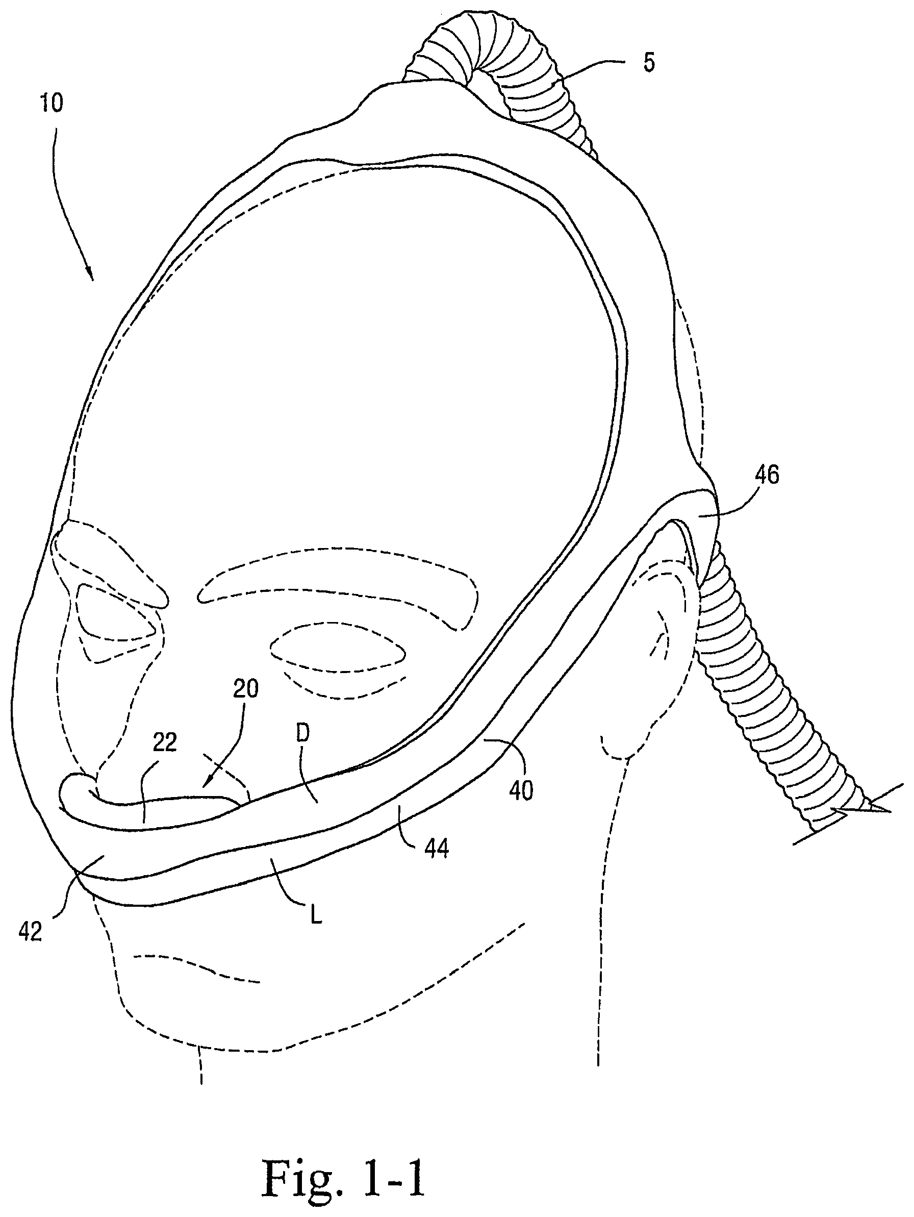 Patent US12472321 Figure 1 – Delivery of respiratory therapy