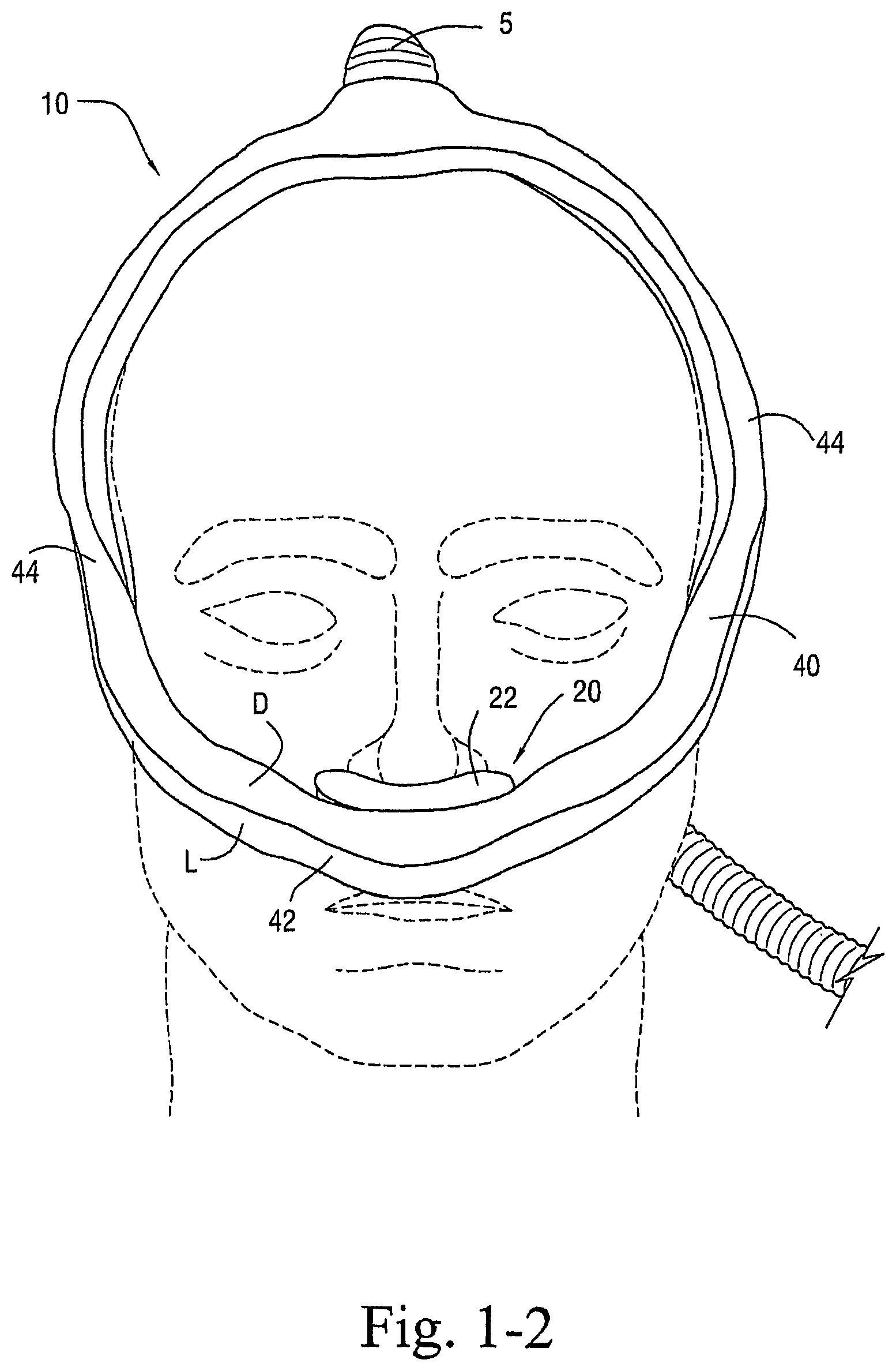 Patent US12472321 Figure 2 – Delivery of respiratory therapy