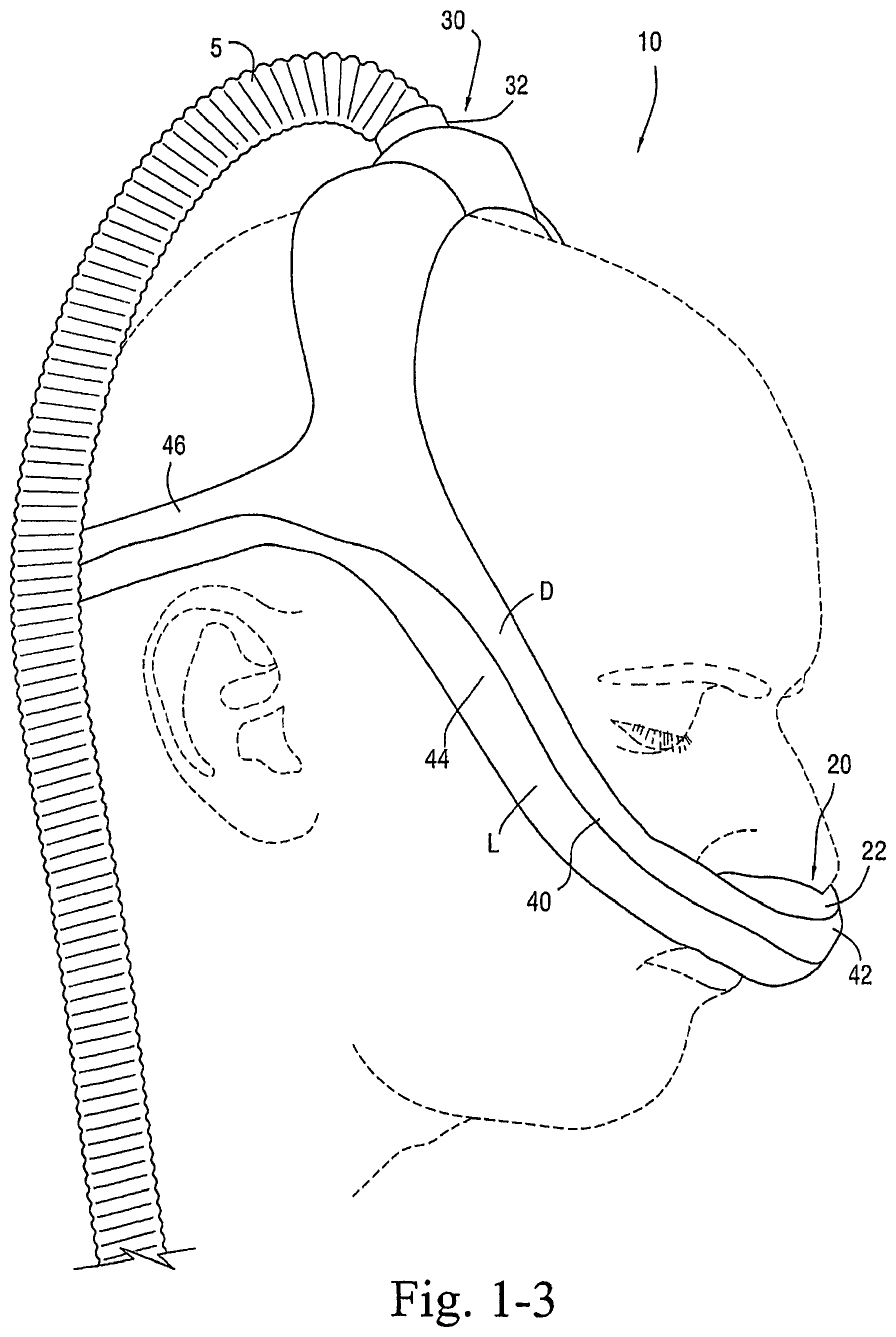Patent US12472321 Figure 3 – Delivery of respiratory therapy