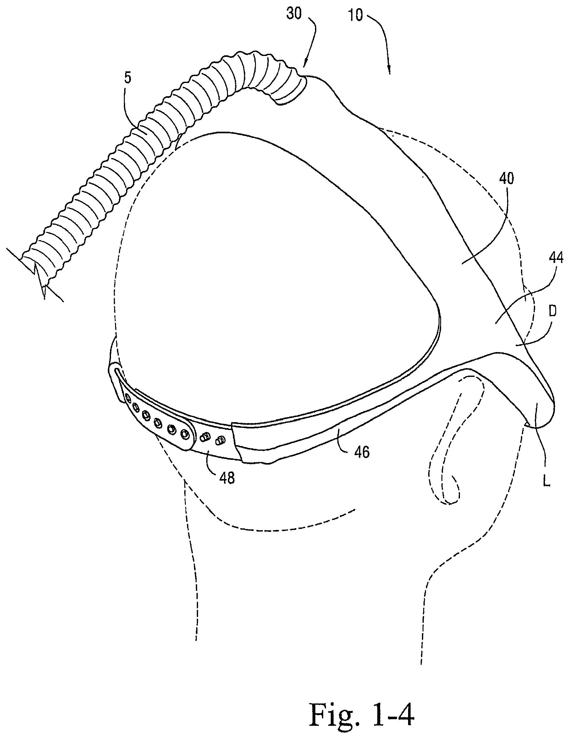 Patent US12472321 Figure 4 – Delivery of respiratory therapy