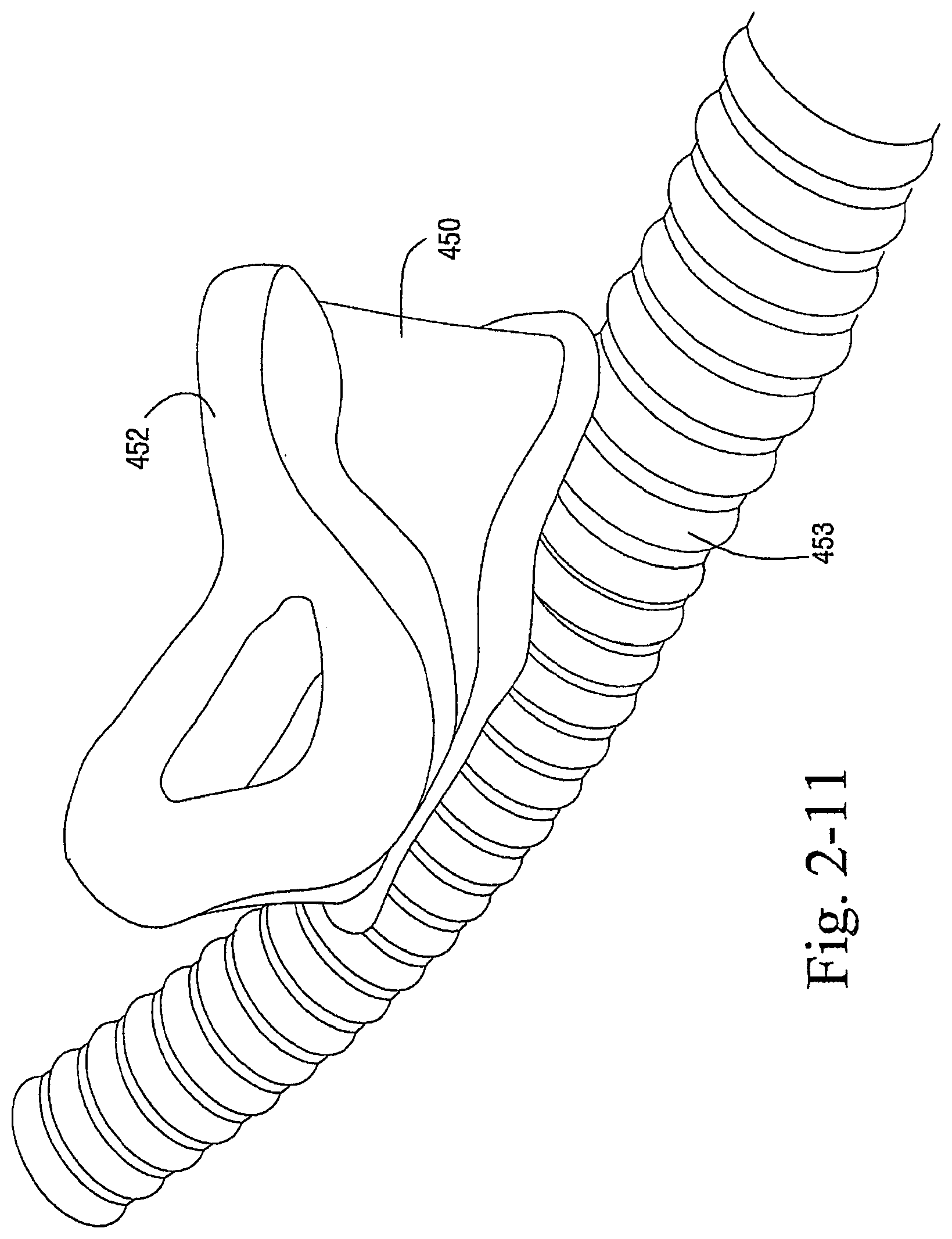 Patent US12472321 Figure 15 – Delivery of respiratory therapy