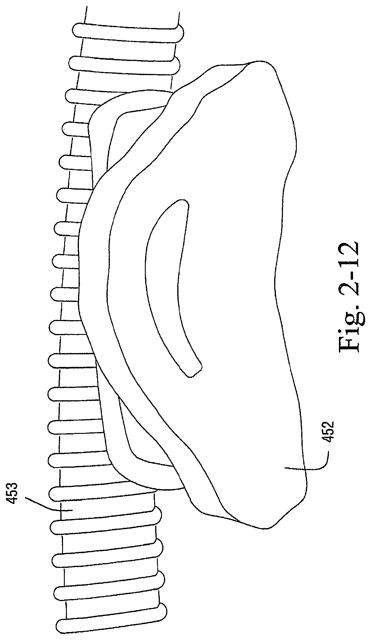 Patent US12472321 Figure 16 – Delivery of respiratory therapy