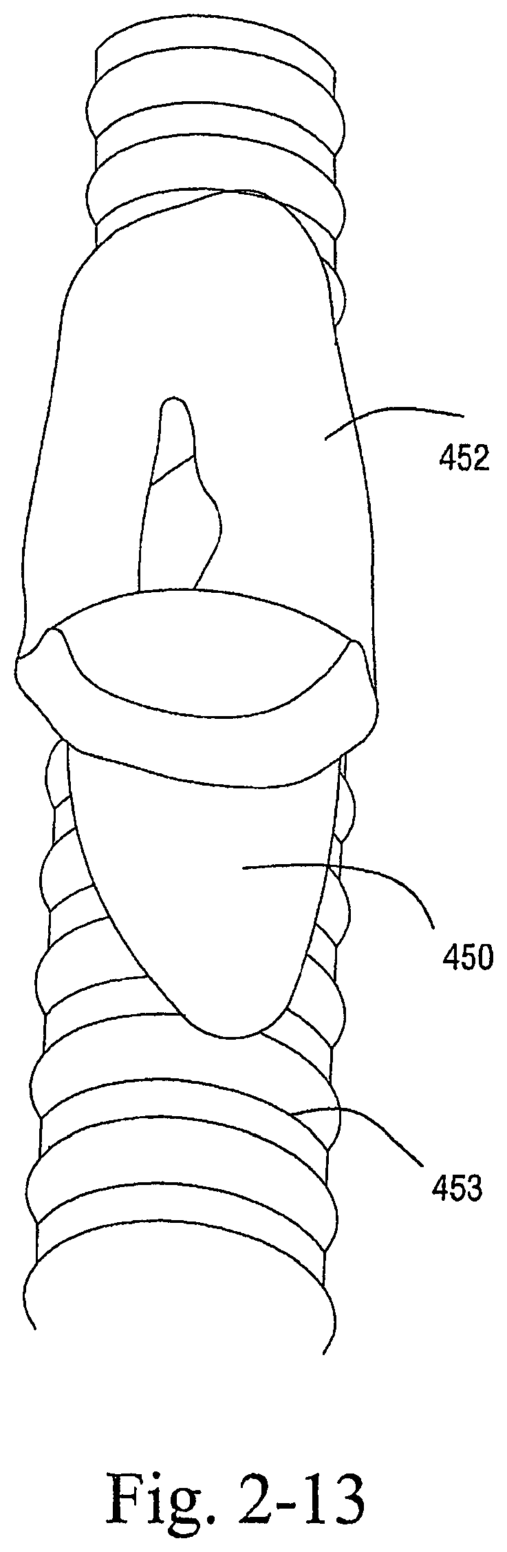 Patent US12472321 Figure 17 – Delivery of respiratory therapy