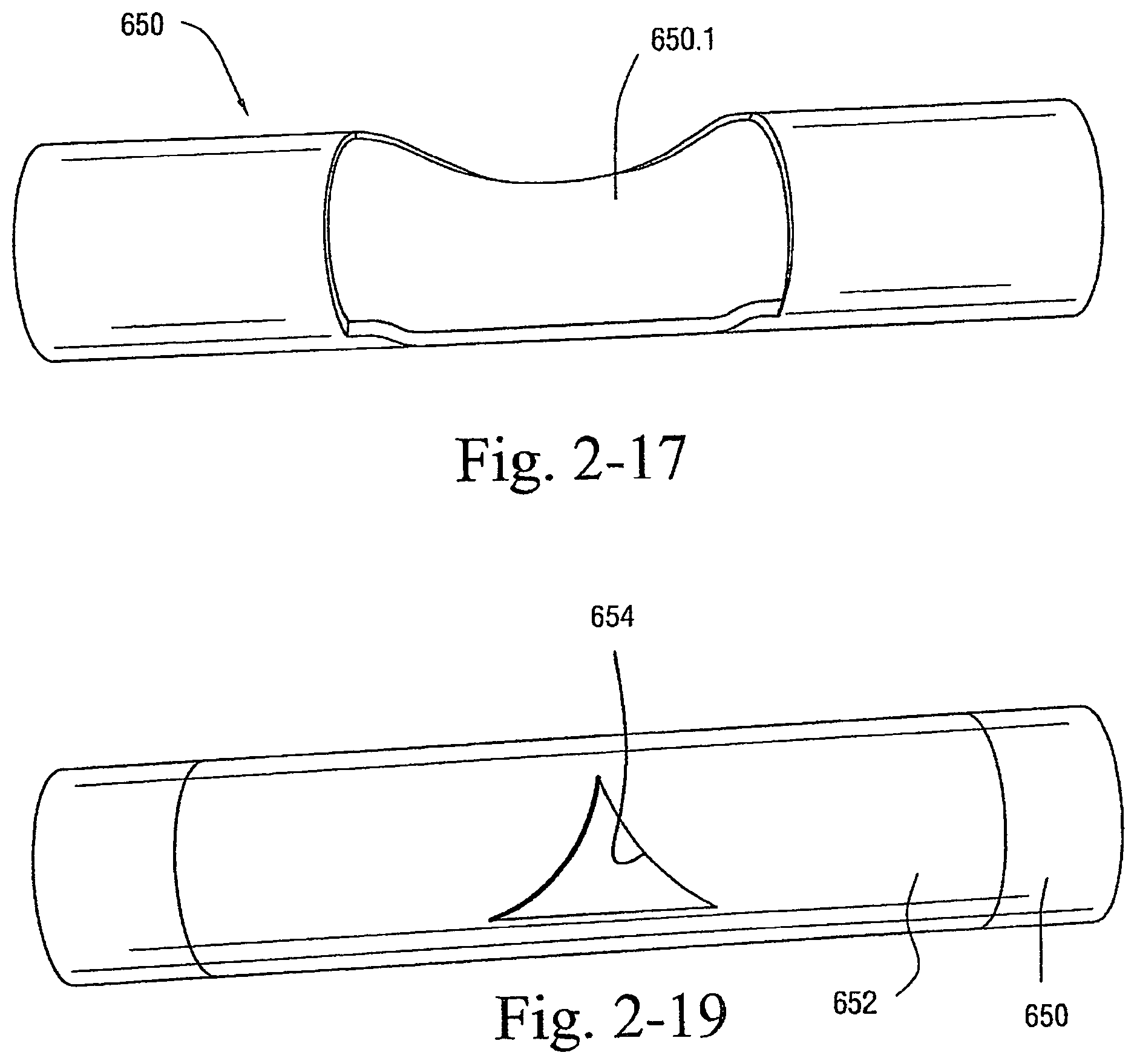 Patent US12472321 Figure 20 – Delivery of respiratory therapy