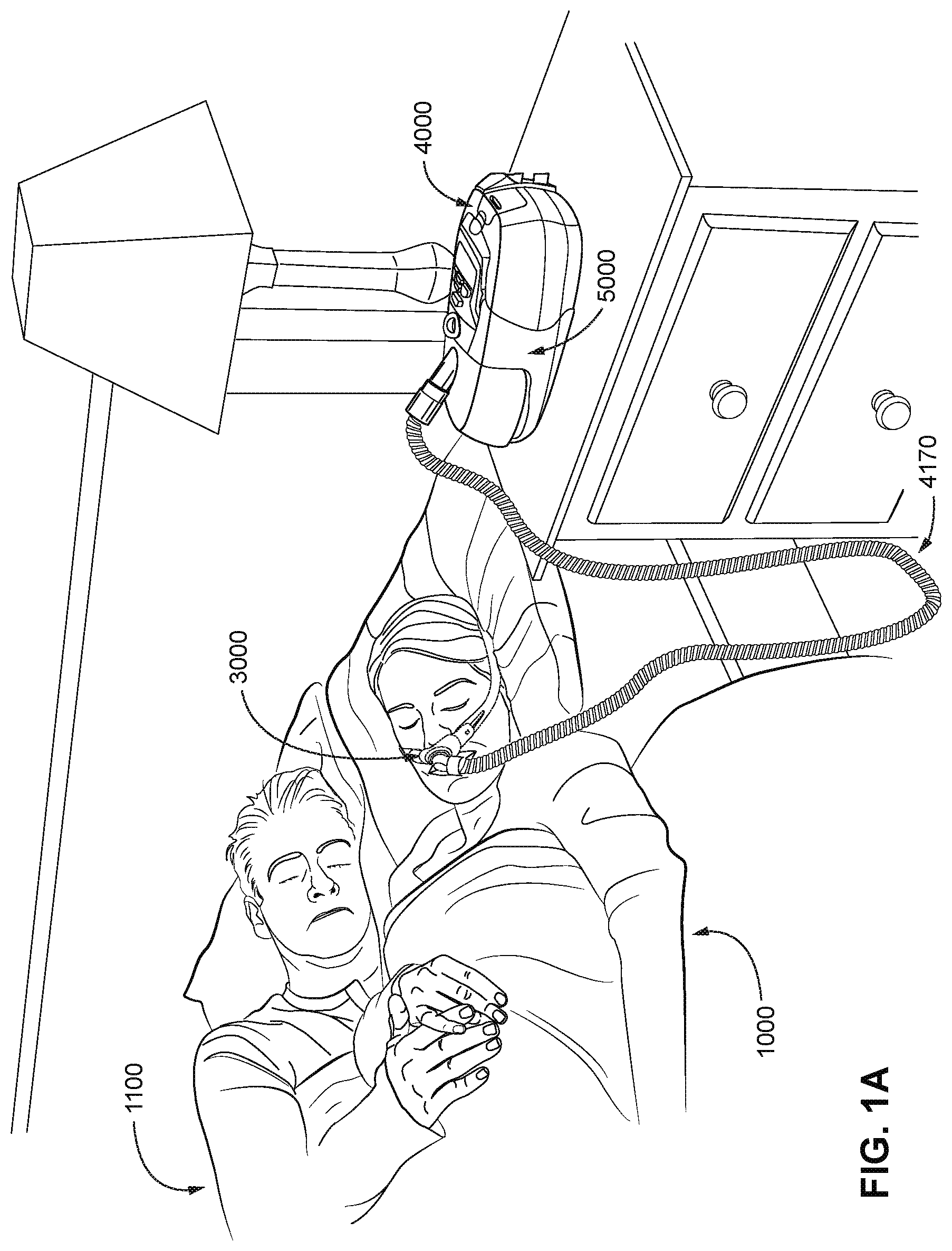 Patent US12472322 Figure 1 – Seal-forming structure for patient interface including textile seal member