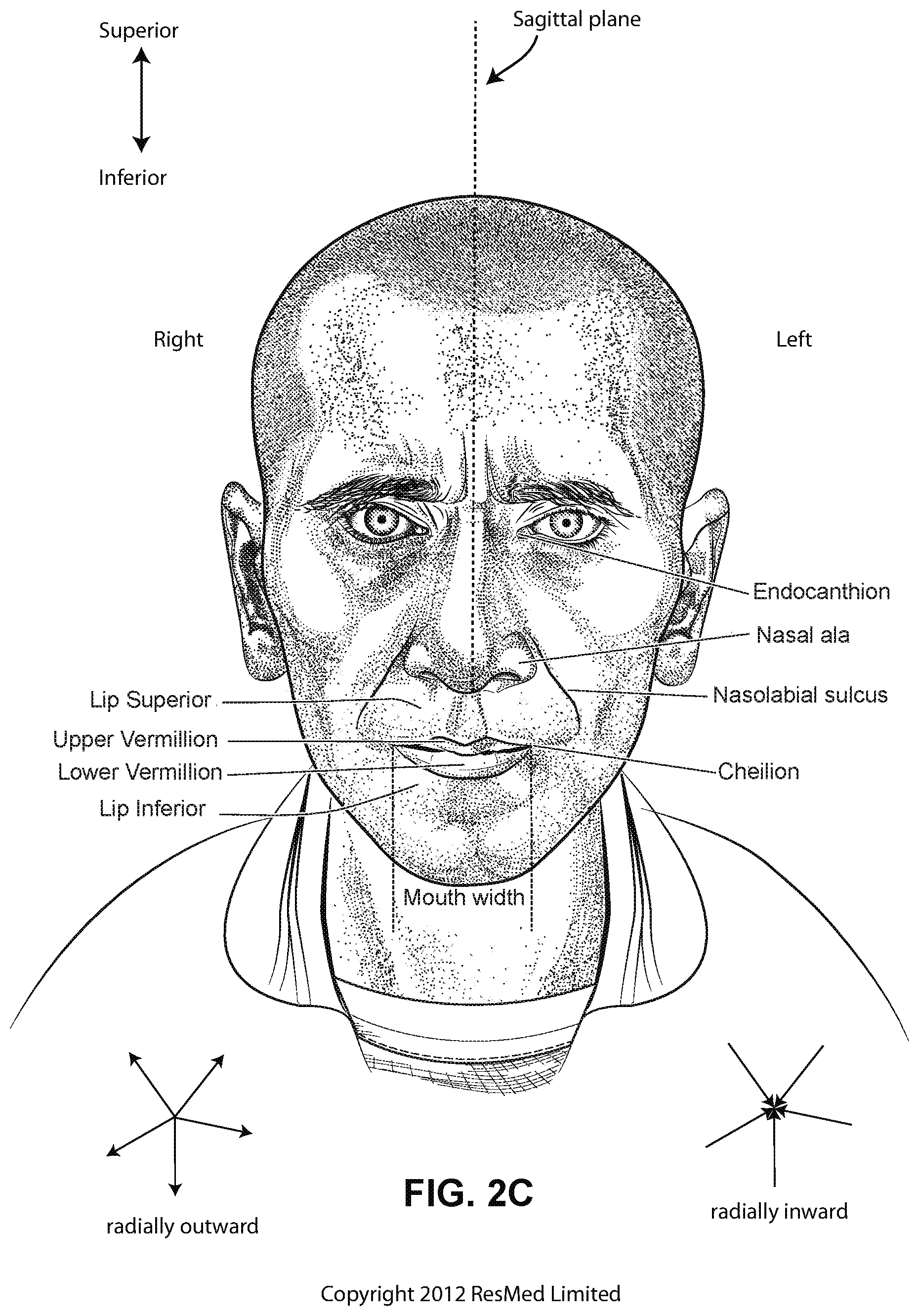 Patent US12472322 Figure 6 – Seal-forming structure for patient interface including textile seal member