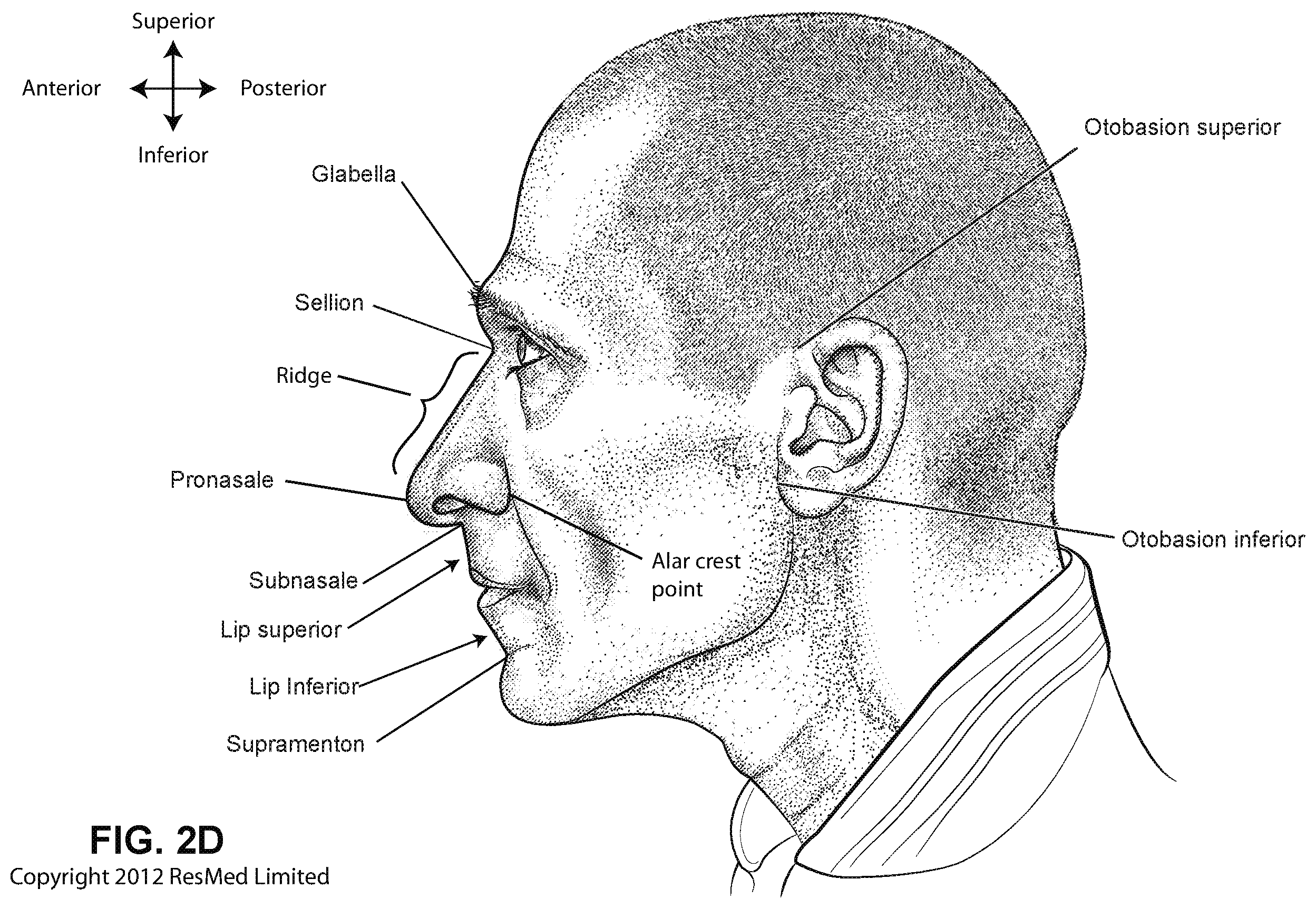 Patent US12472322 Figure 7 – Seal-forming structure for patient interface including textile seal member