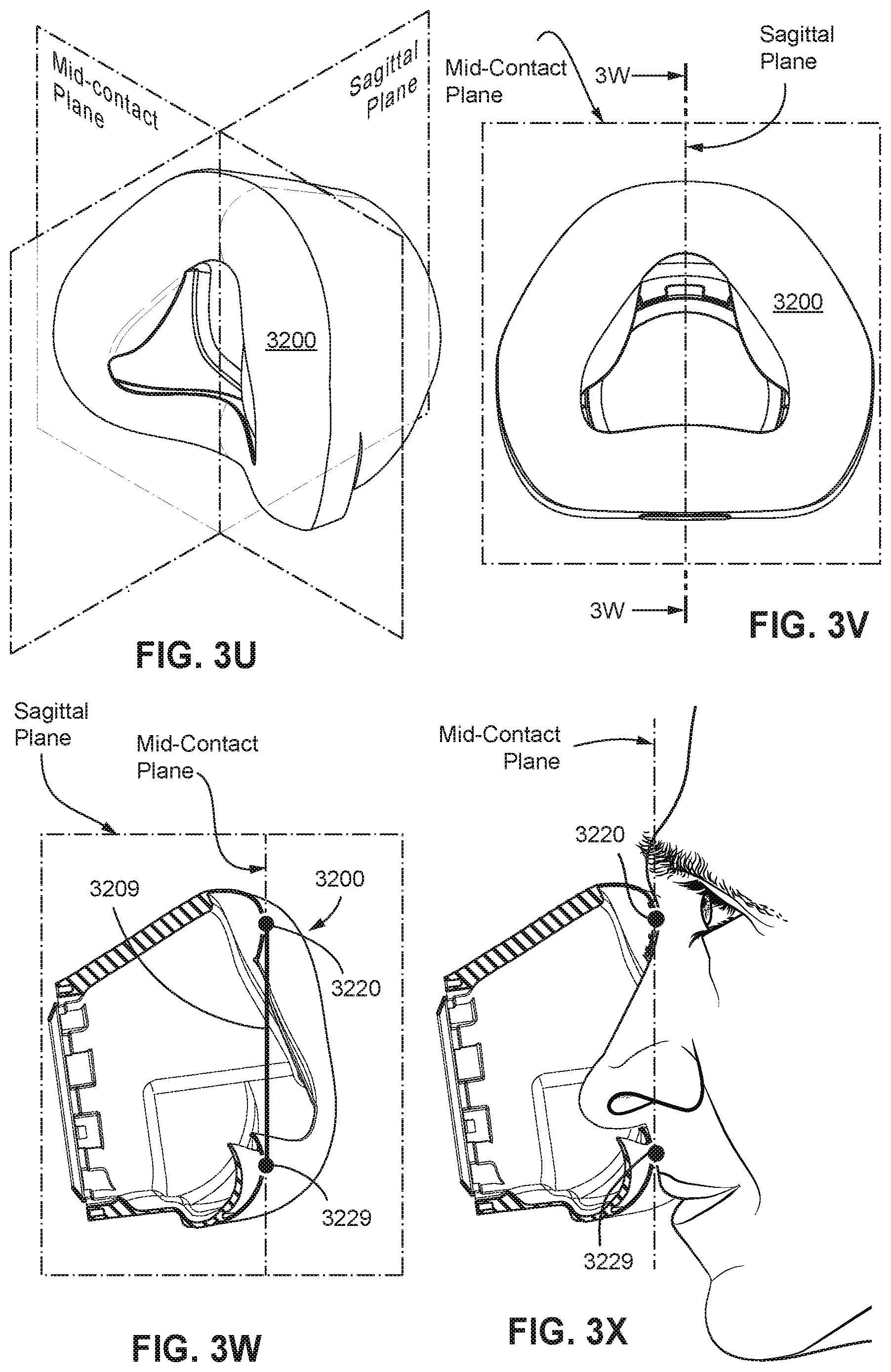 Patent US12472322 Figure 18 – Seal-forming structure for patient interface including textile seal member