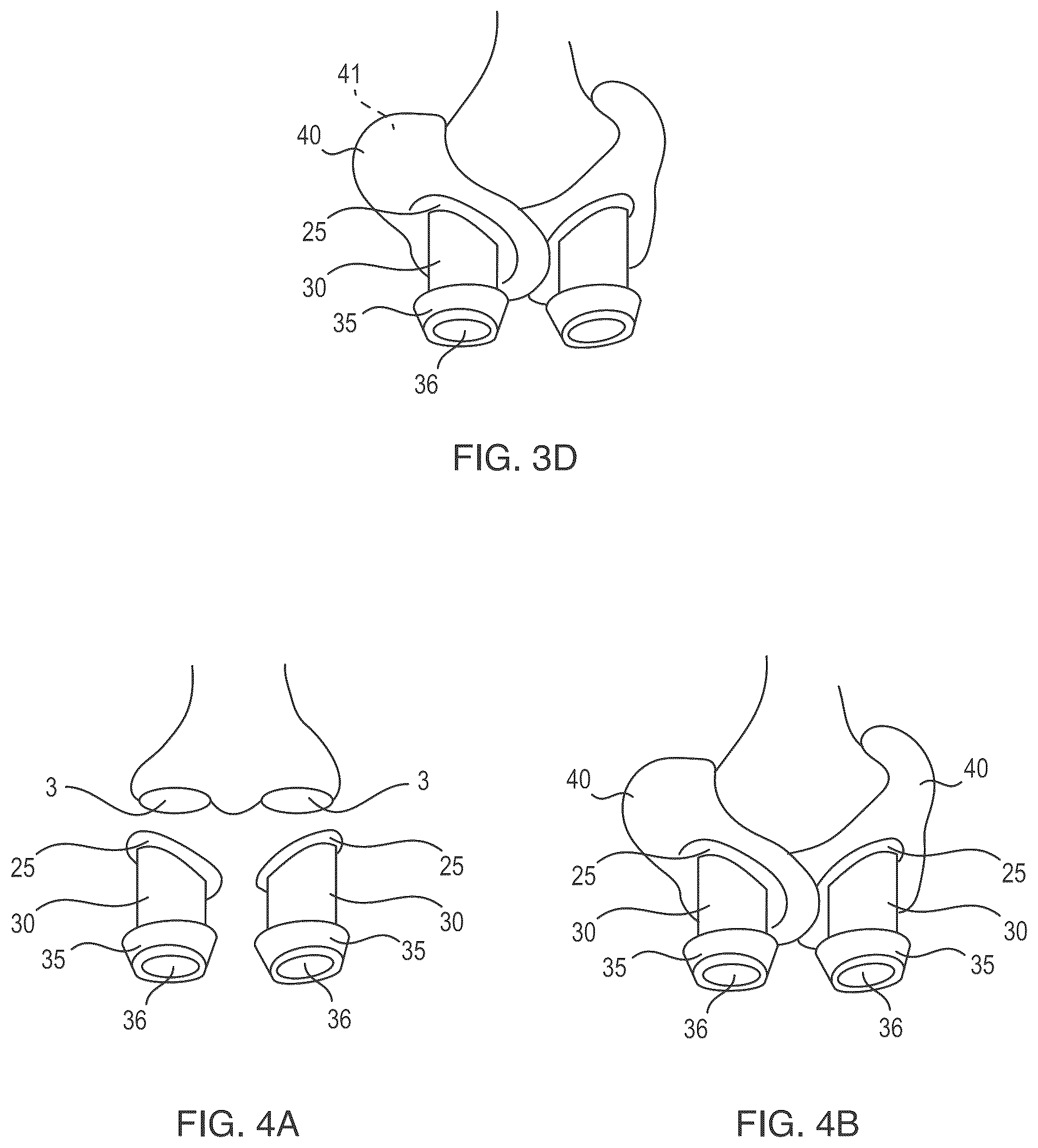 Patent US12472324 Figure 4 – Self-sanitizing respiratory assembly and methods of making and using the same
