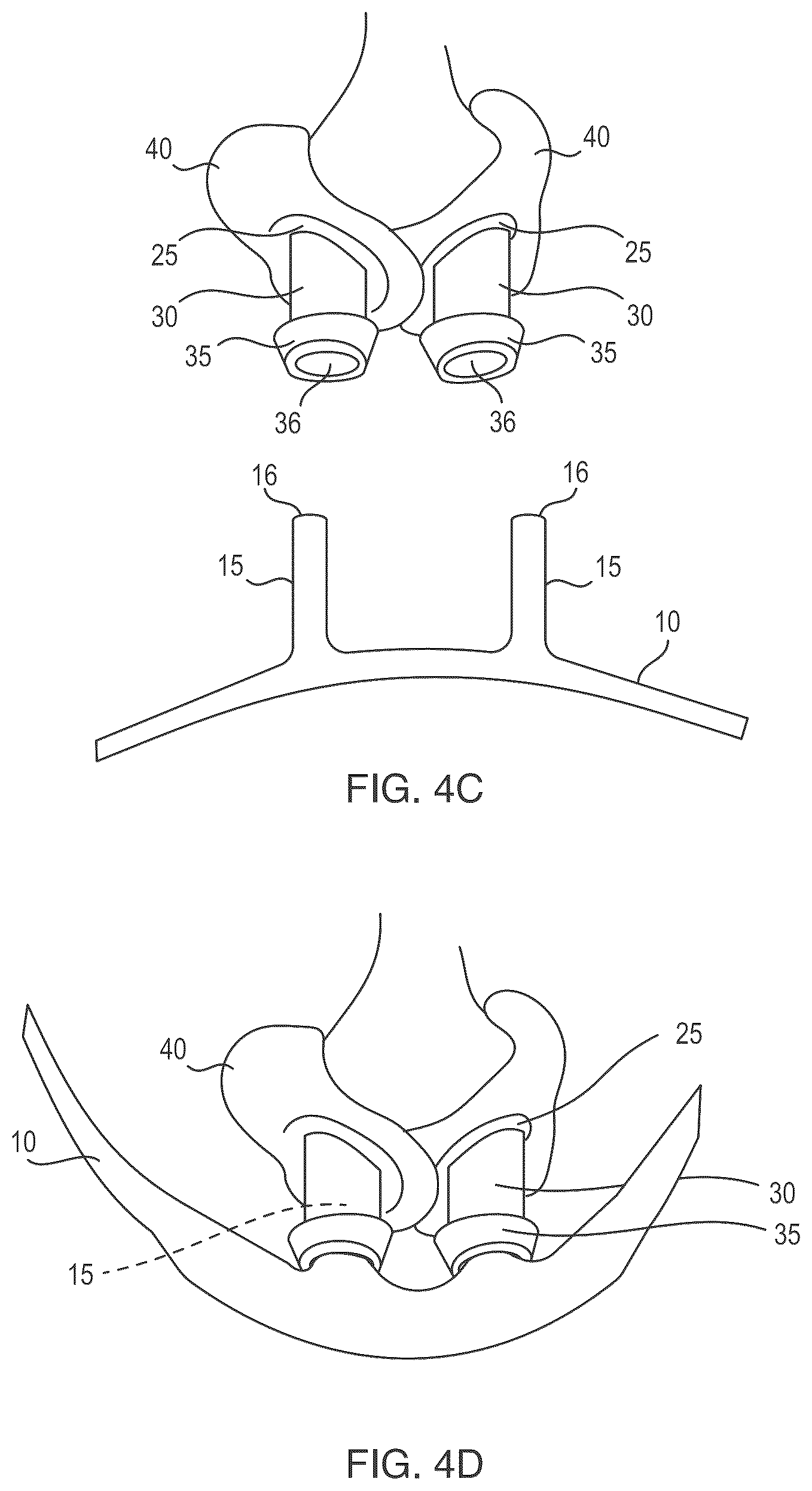 Patent US12472324 Figure 5 – Self-sanitizing respiratory assembly and methods of making and using the same