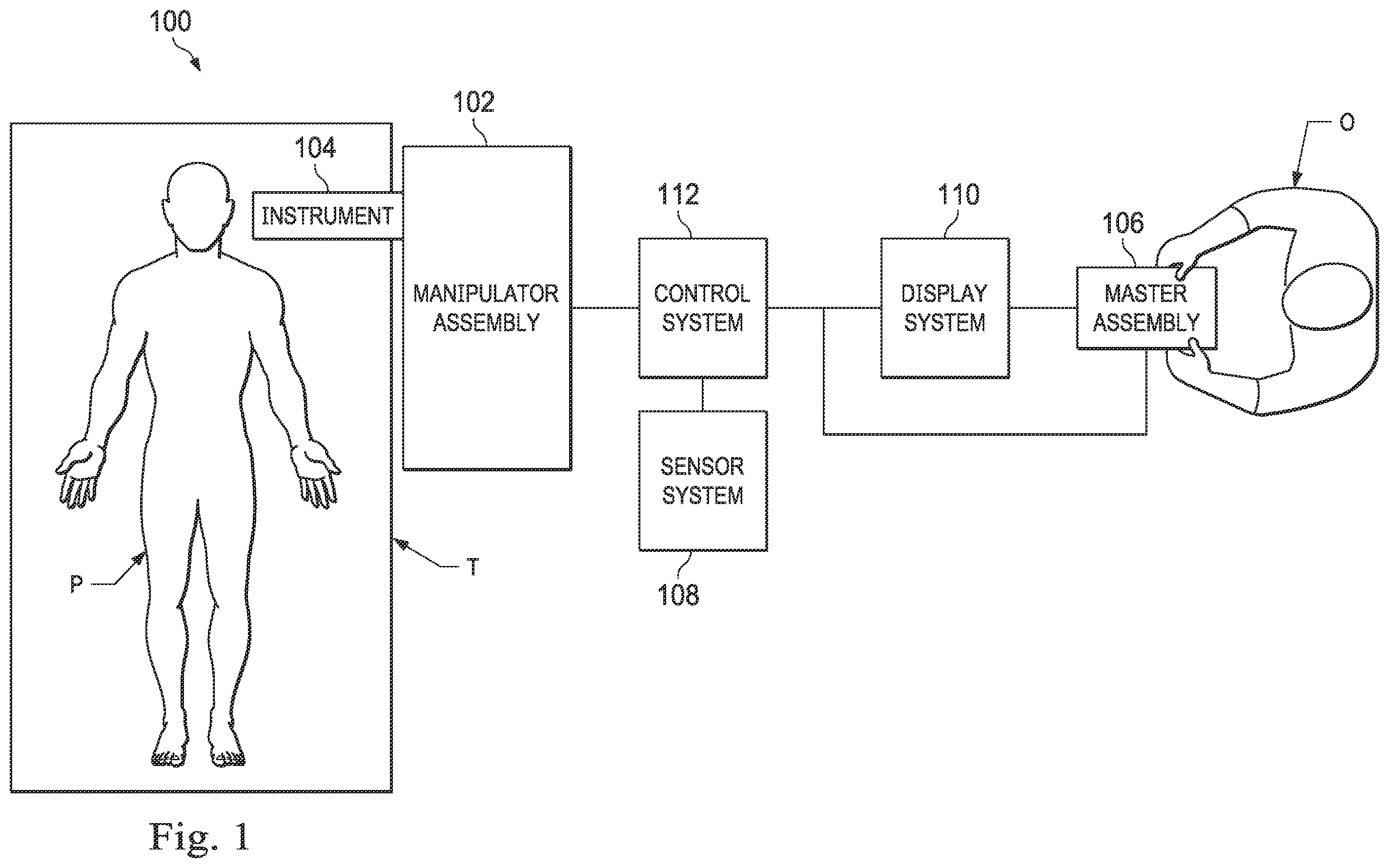 Patent US12472328 Figure 1 – Systems and methods for determining buckling and patient movement during a medical procedure