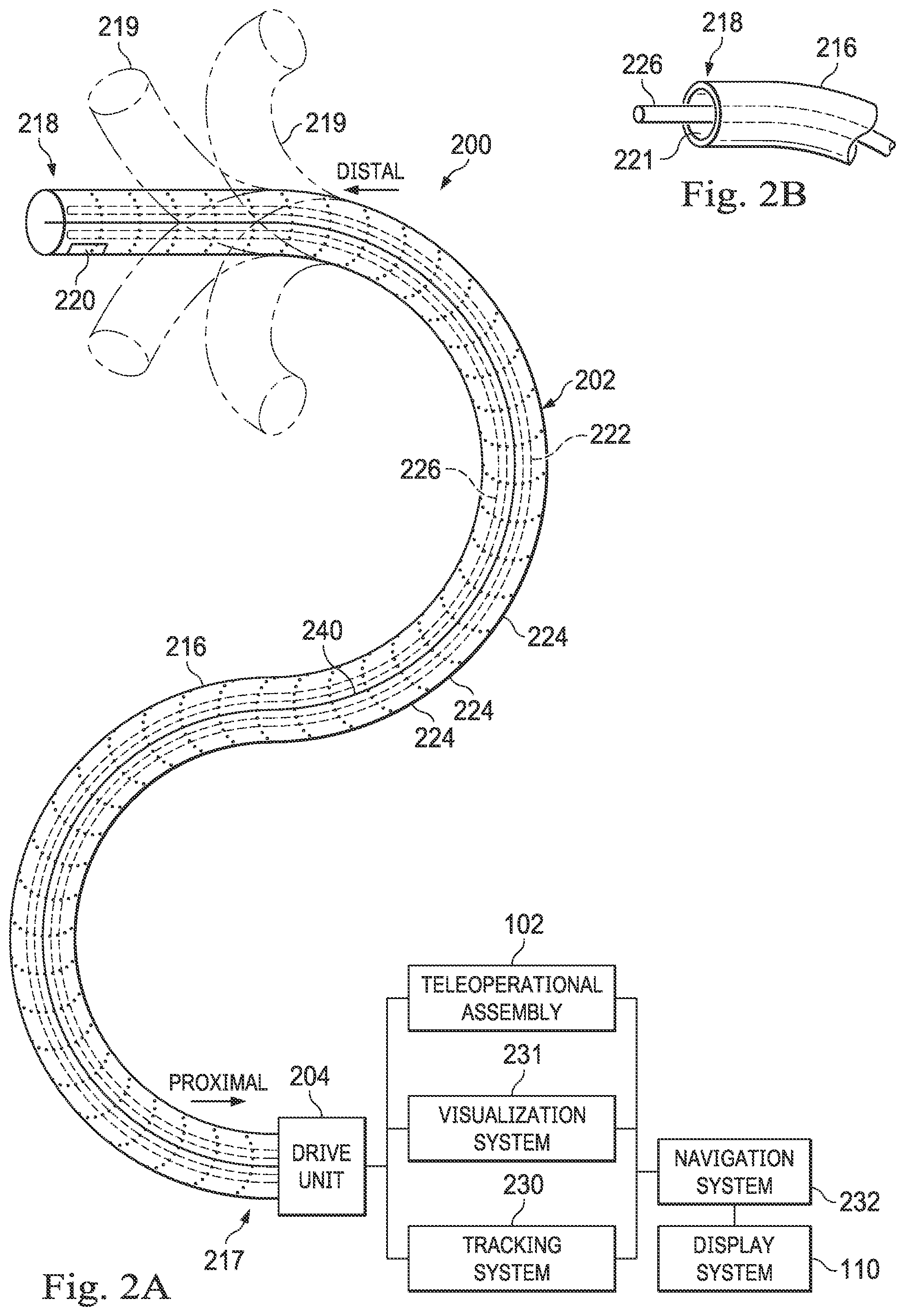Patent US12472328 Figure 2 – Systems and methods for determining buckling and patient movement during a medical procedure