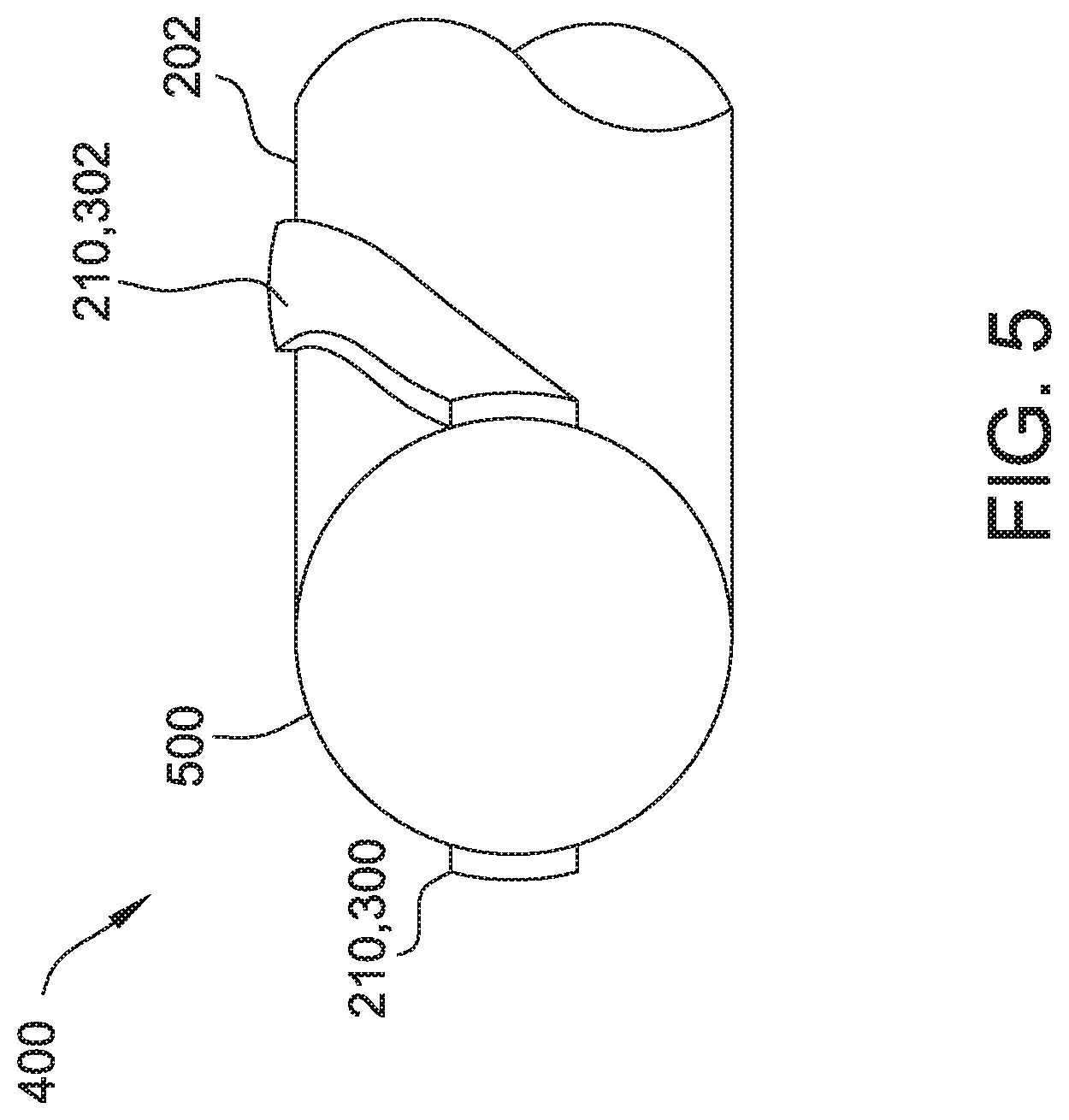 Patent US12472329 Figure 5 – Torqueable steerable sheaths