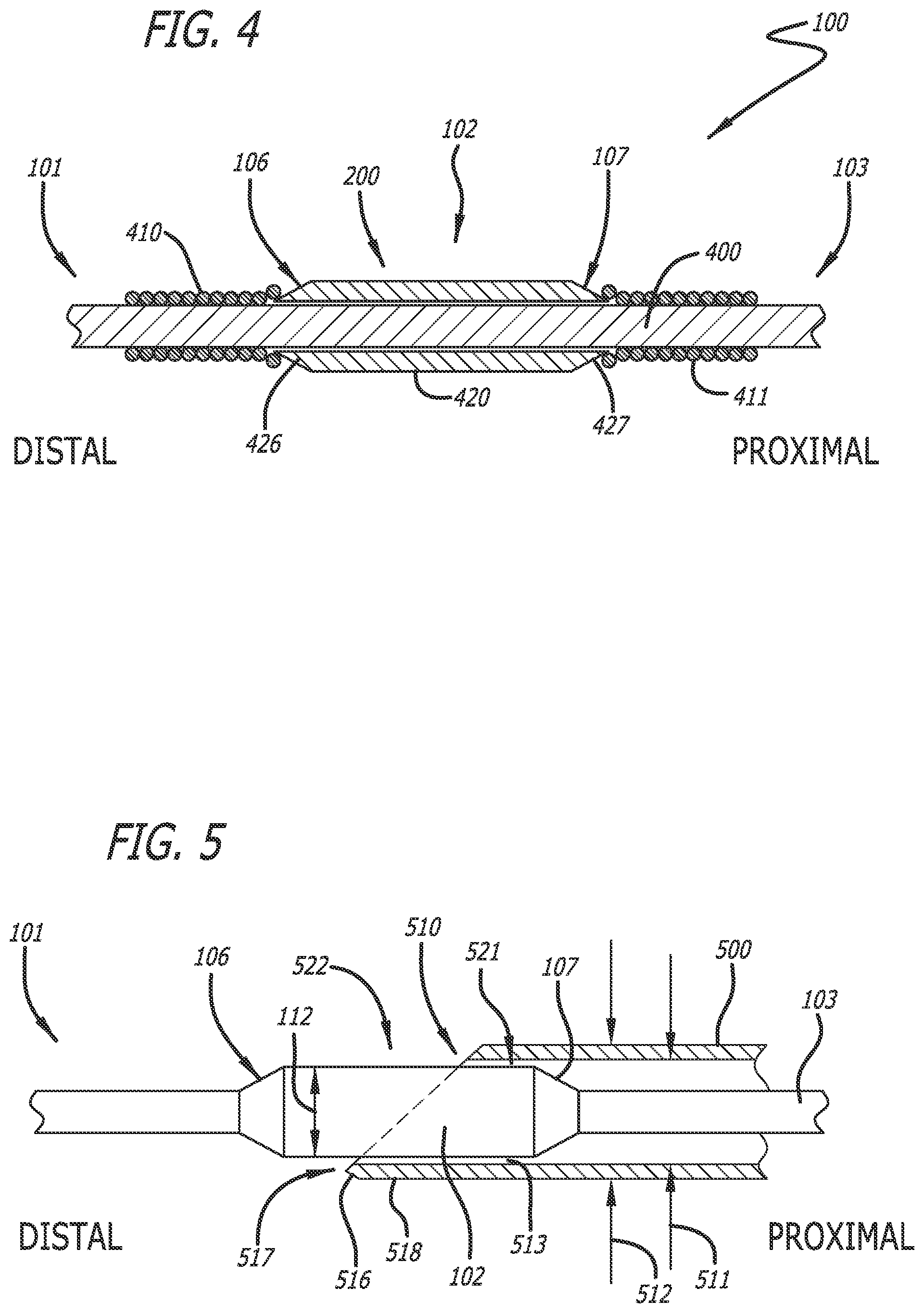 Patent US12472331 Figure 3 – Needle tip blunting using a length of a guidewire