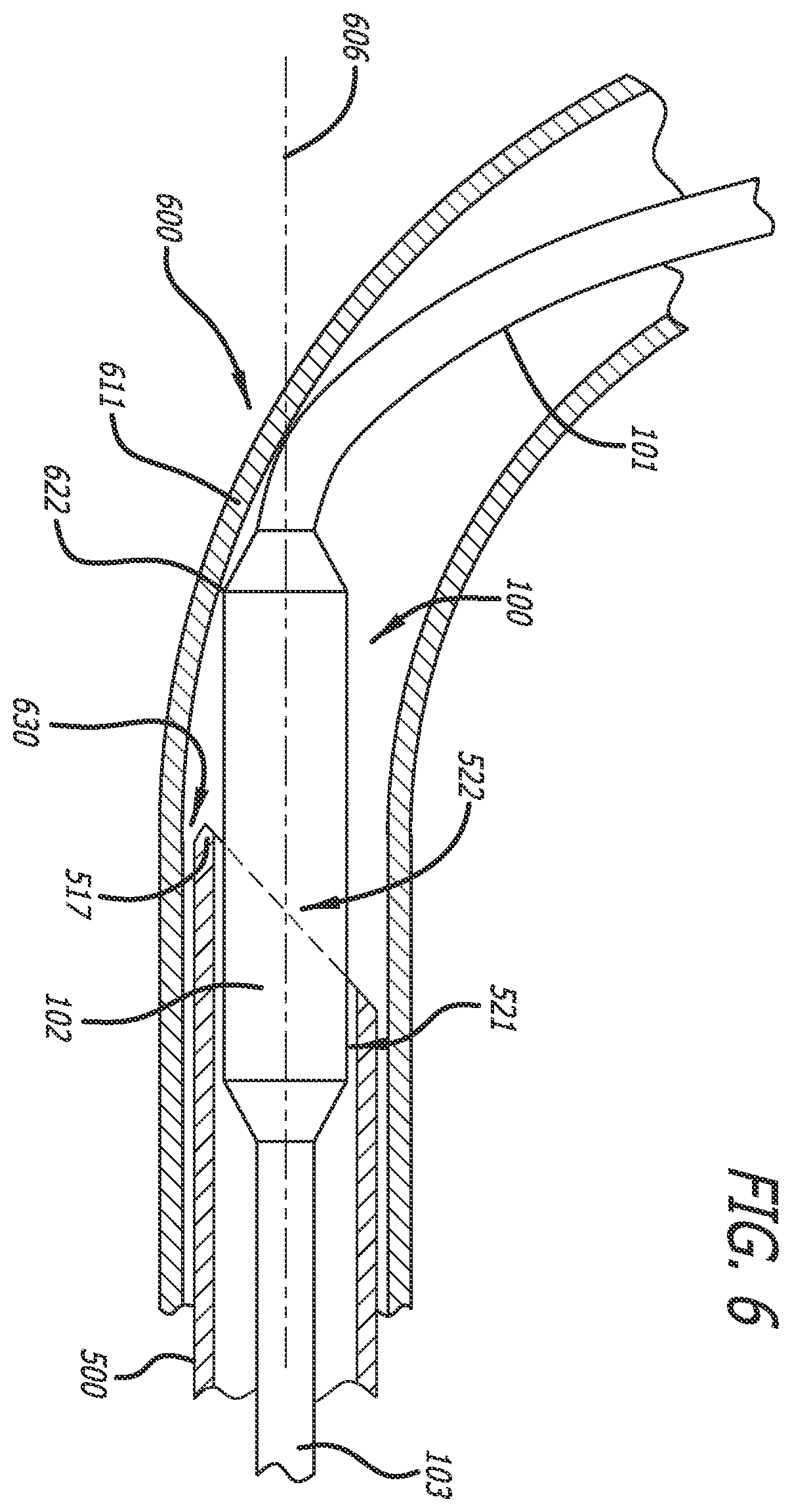 Patent US12472331 Figure 4 – Needle tip blunting using a length of a guidewire