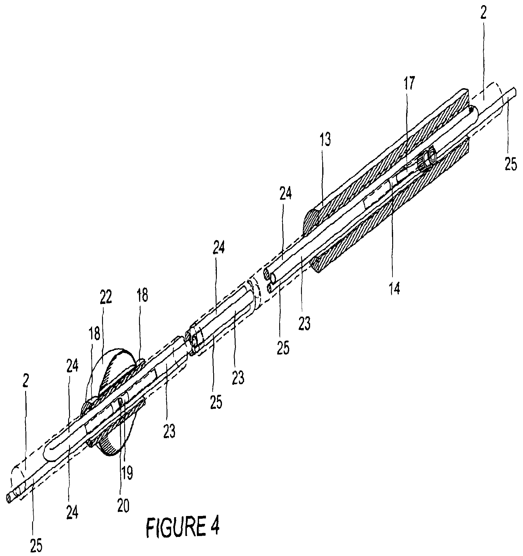 Patent US12472333 Figure 3 – Mobile balloon support catheter