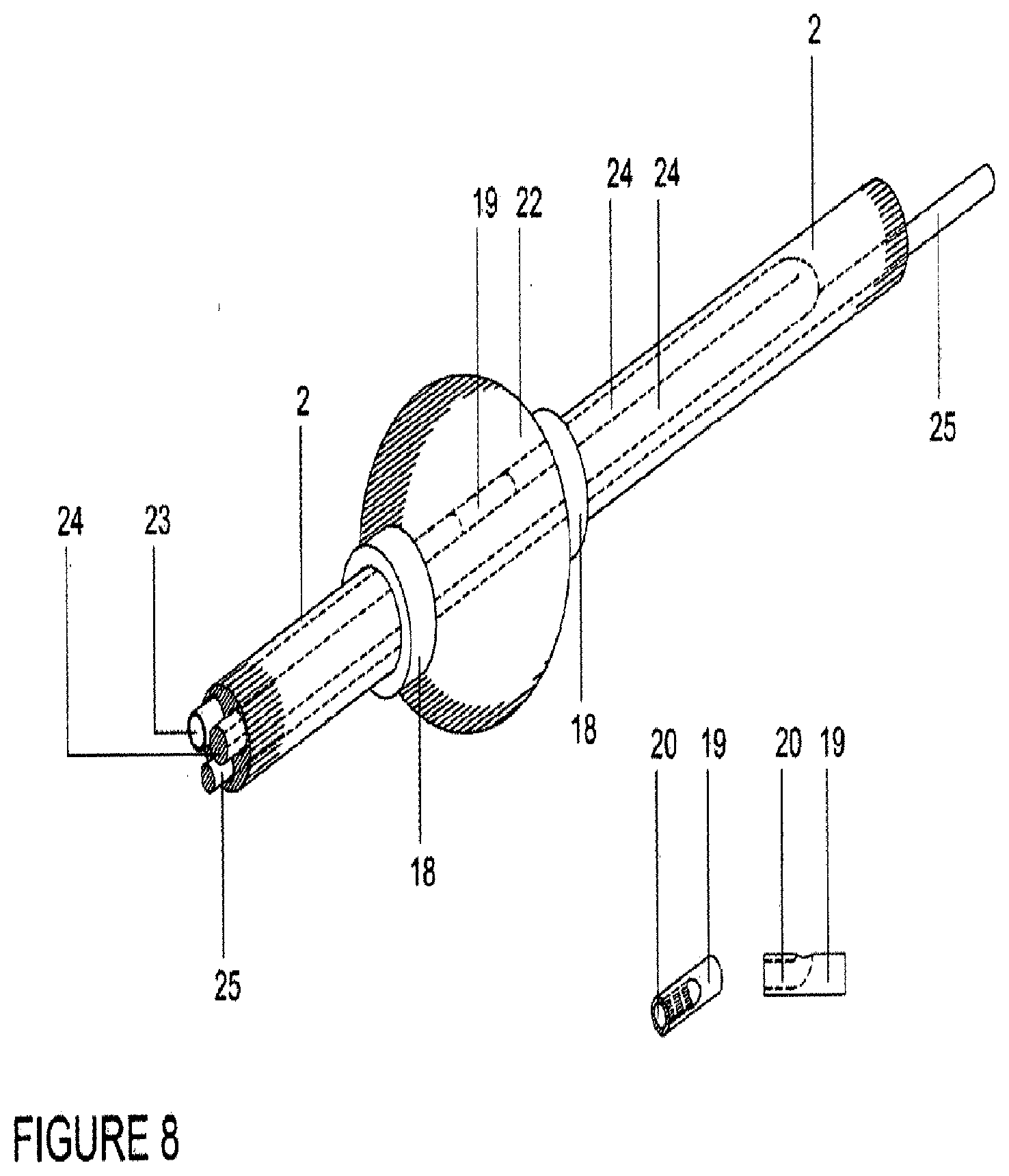 Patent US12472333 Figure 7 – Mobile balloon support catheter