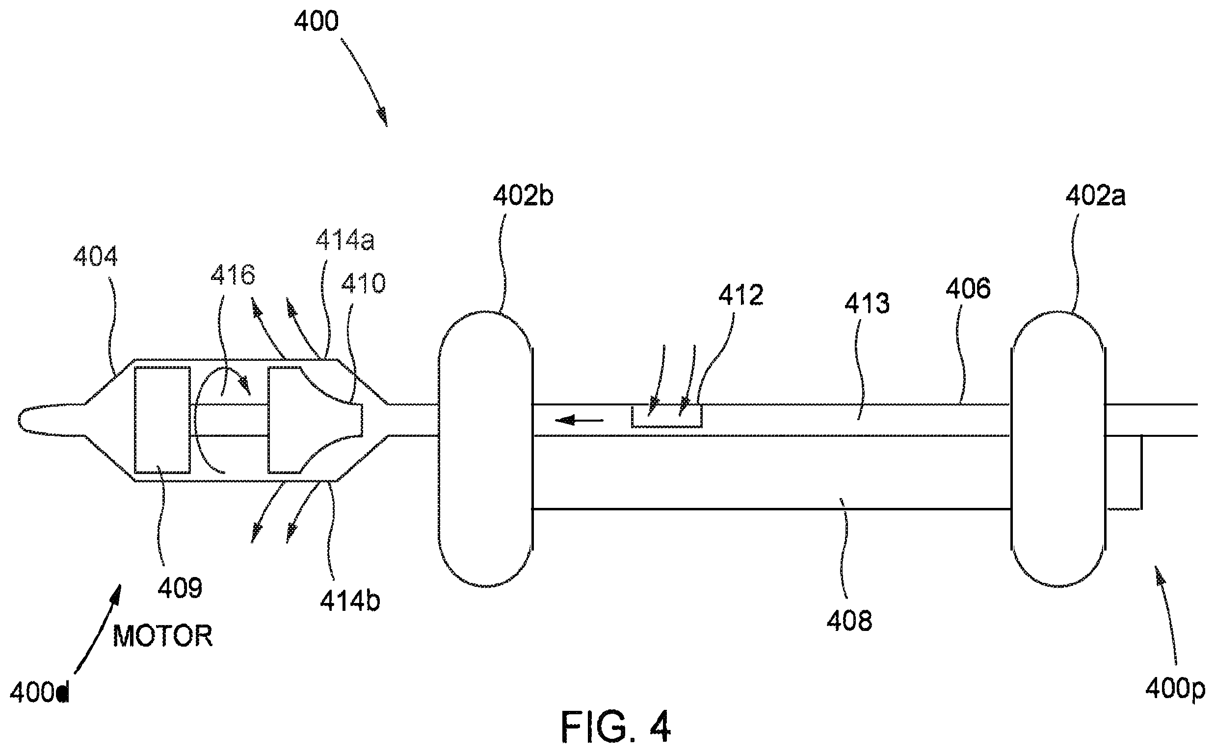 Patent US12472334 Figure 4 – Systems and methods for treatment of fluid overload