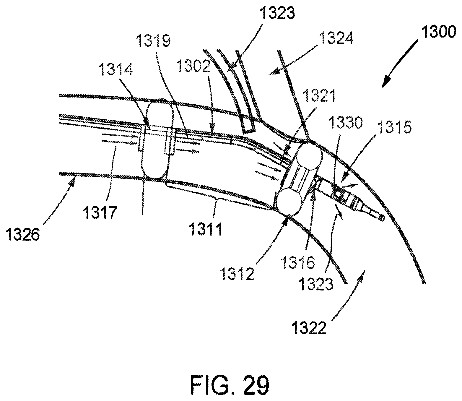 Patent US12472334 Figure 20 – Systems and methods for treatment of fluid overload