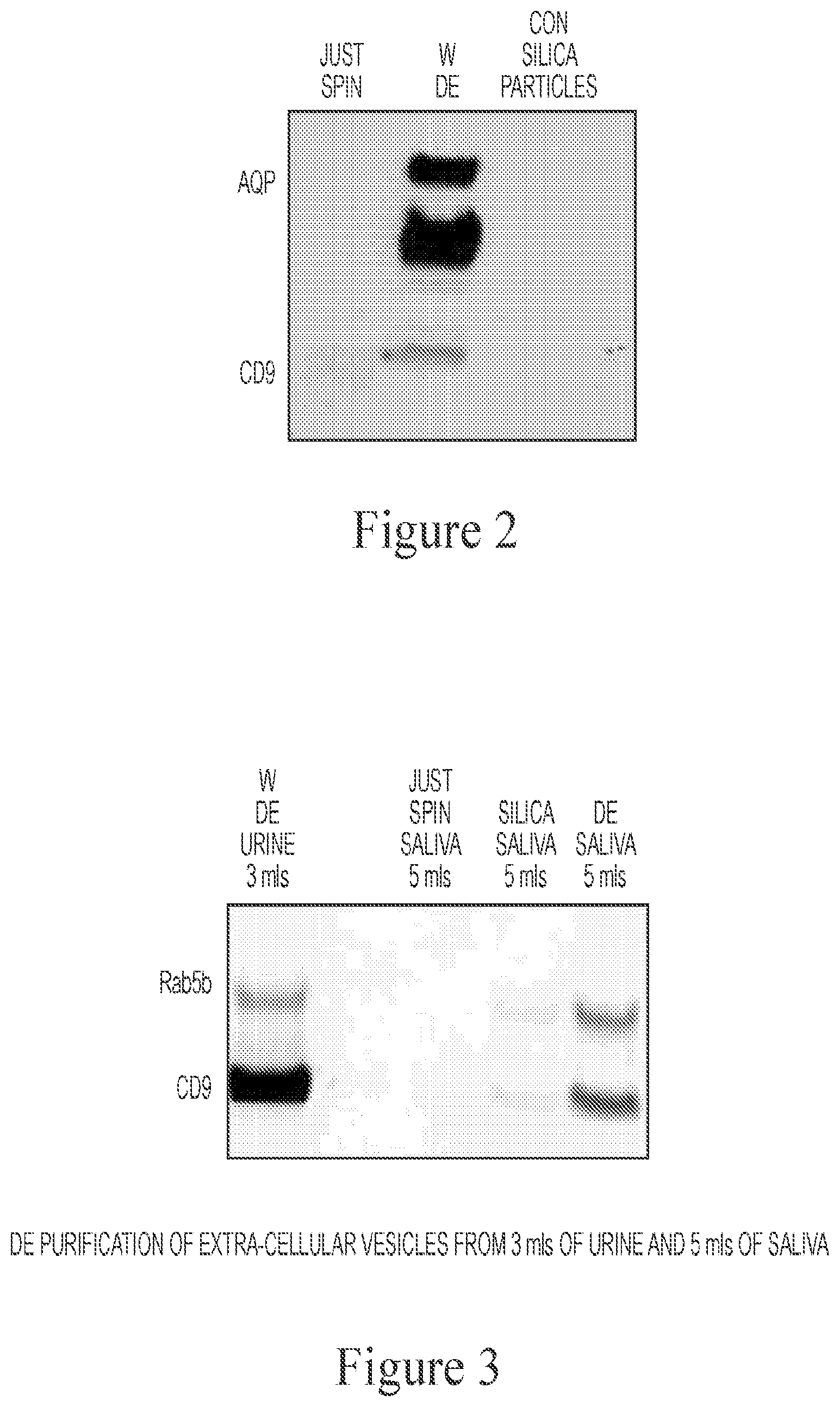 Patent US12472335 Figure 2 – Reduction of bioparticle levels of an organism