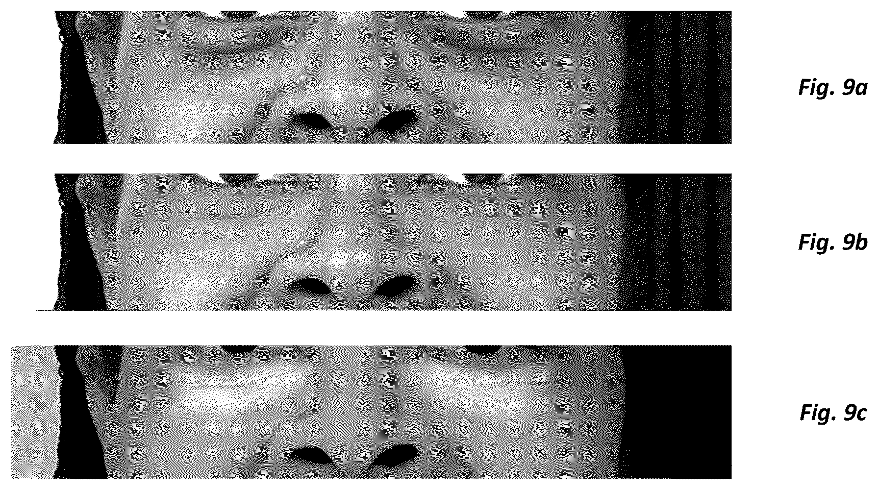 Patent US12472336 Figure 7 – System and method for selective application of cosmetic composition to impart undereye brightening