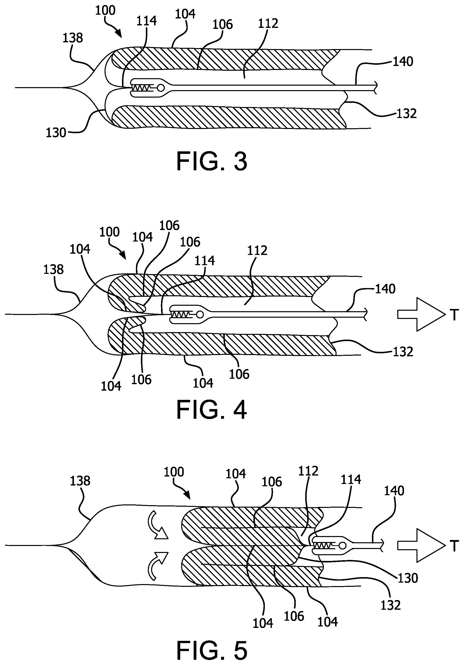 Patent US12472337 Figure 2 – Atraumatic removable cell encapsulation devices