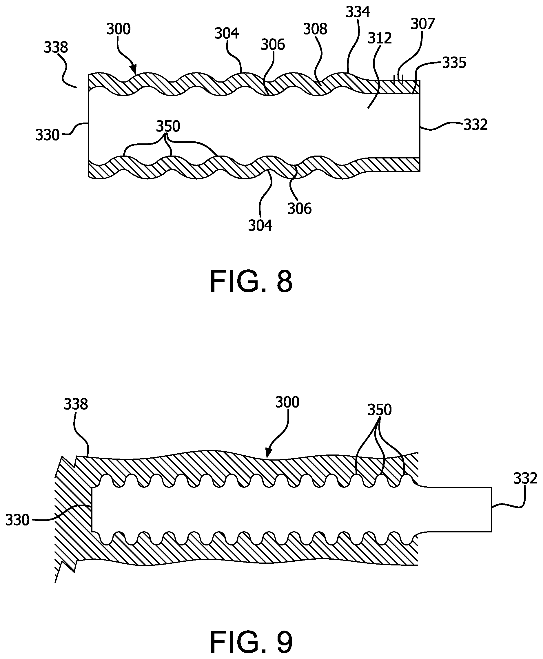 Patent US12472337 Figure 4 – Atraumatic removable cell encapsulation devices