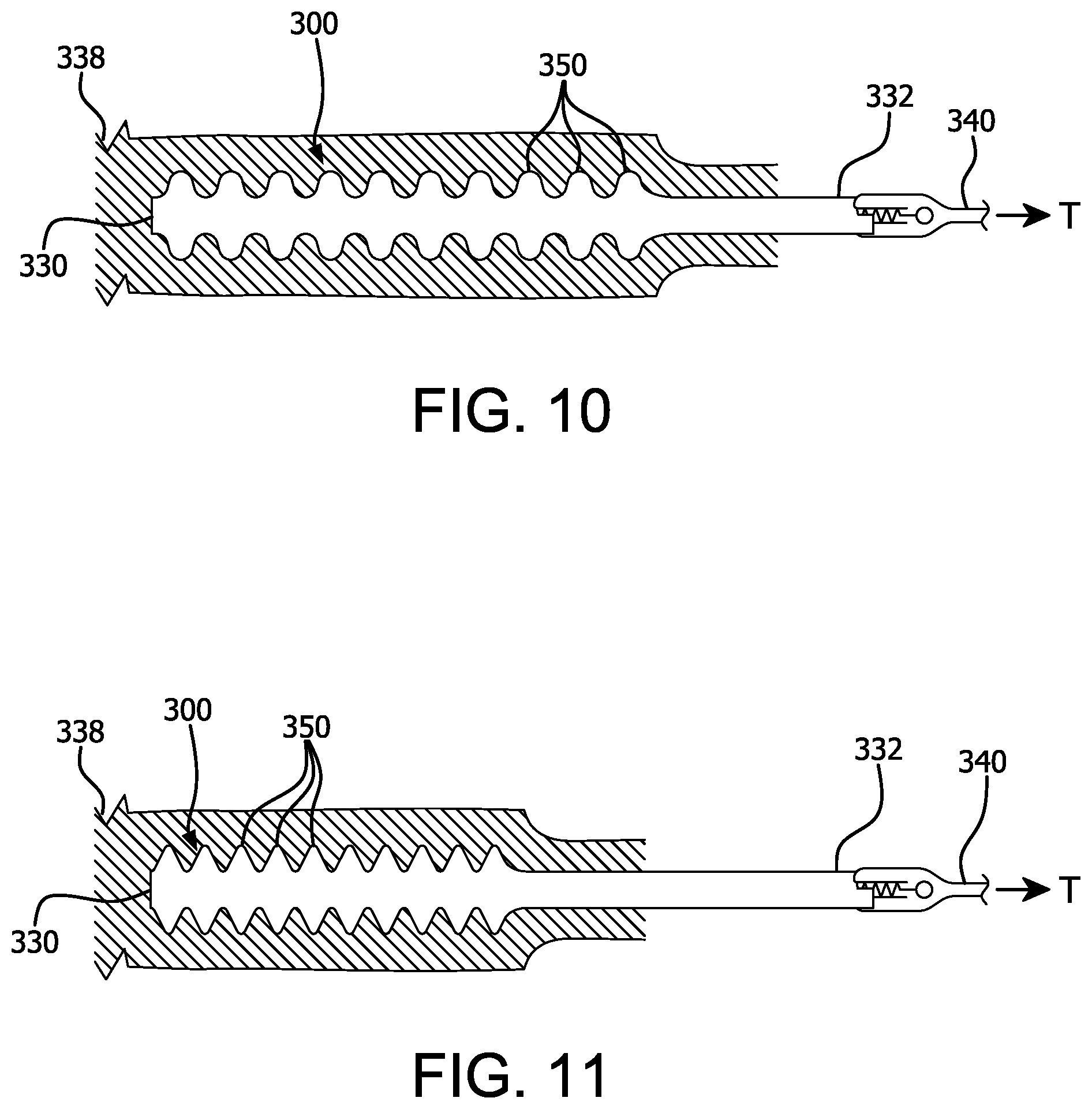Patent US12472337 Figure 5 – Atraumatic removable cell encapsulation devices