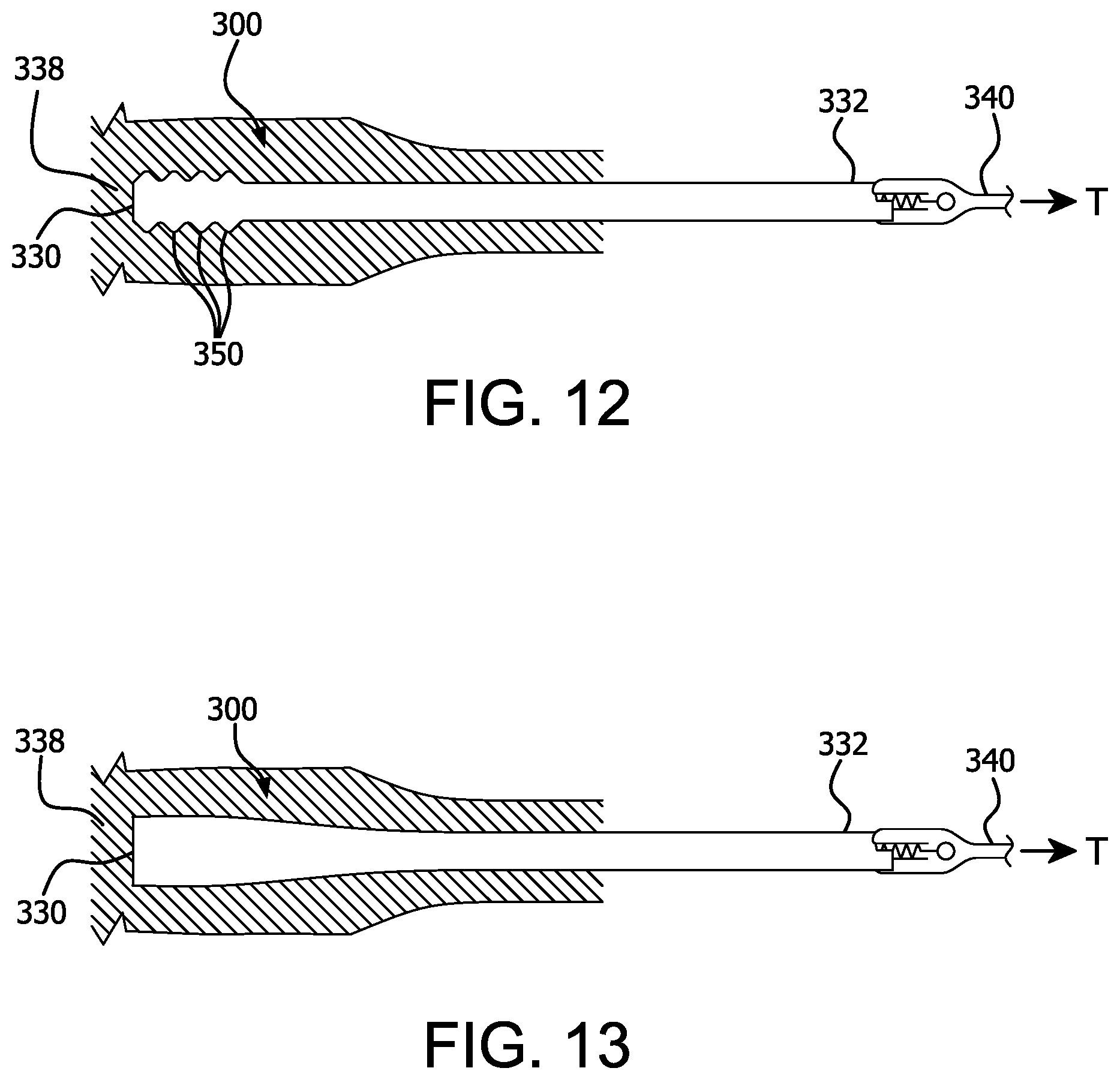 Patent US12472337 Figure 6 – Atraumatic removable cell encapsulation devices