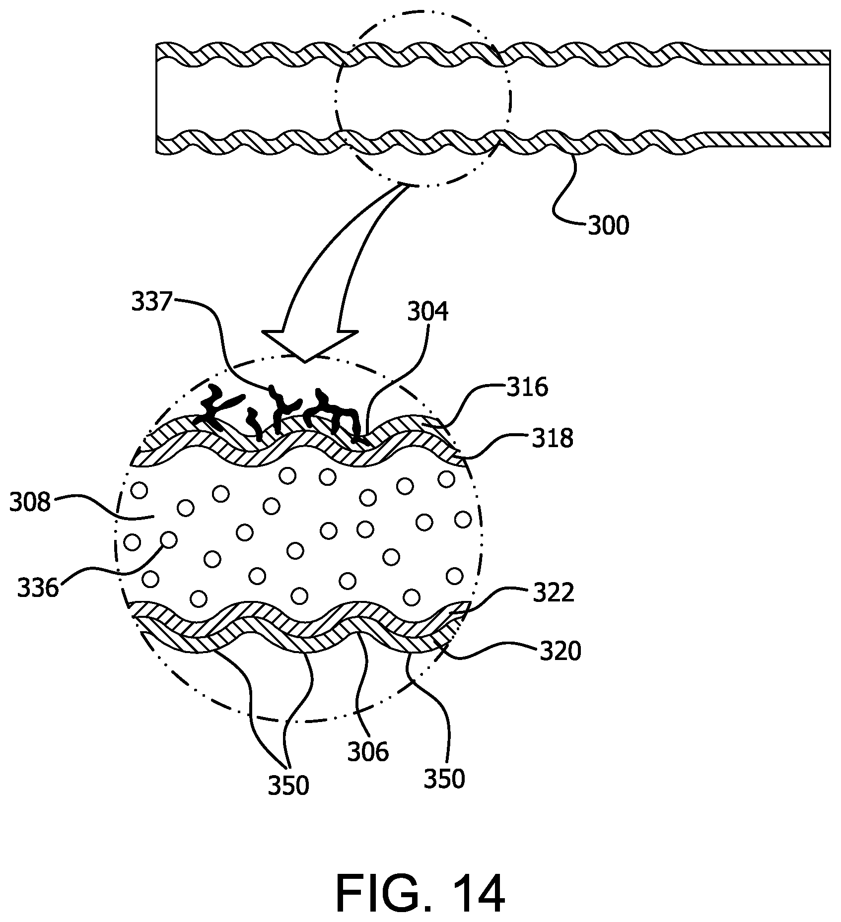 Patent US12472337 Figure 7 – Atraumatic removable cell encapsulation devices