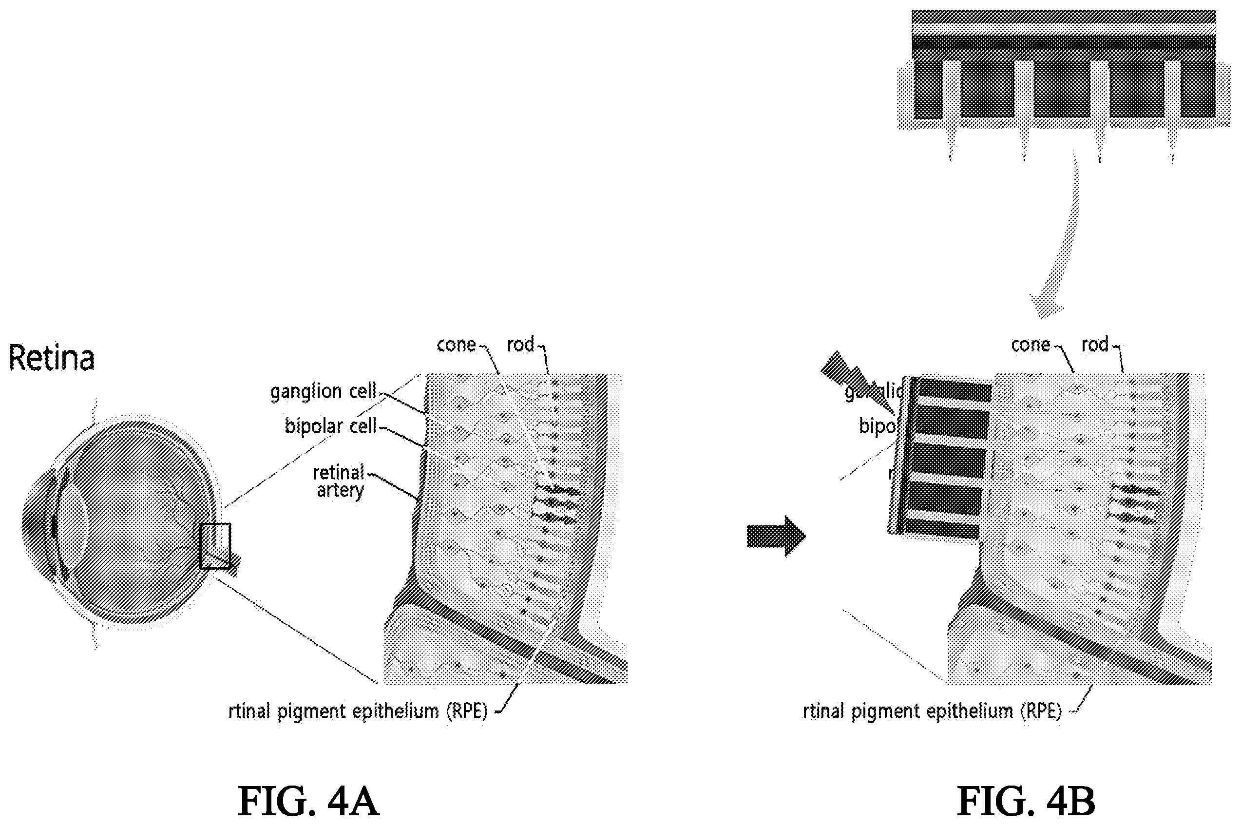 Patent US12472338 Figure 4 – Microneedle array-based electrode comprising organic photovoltaic substances and artificial retina device comprising the same