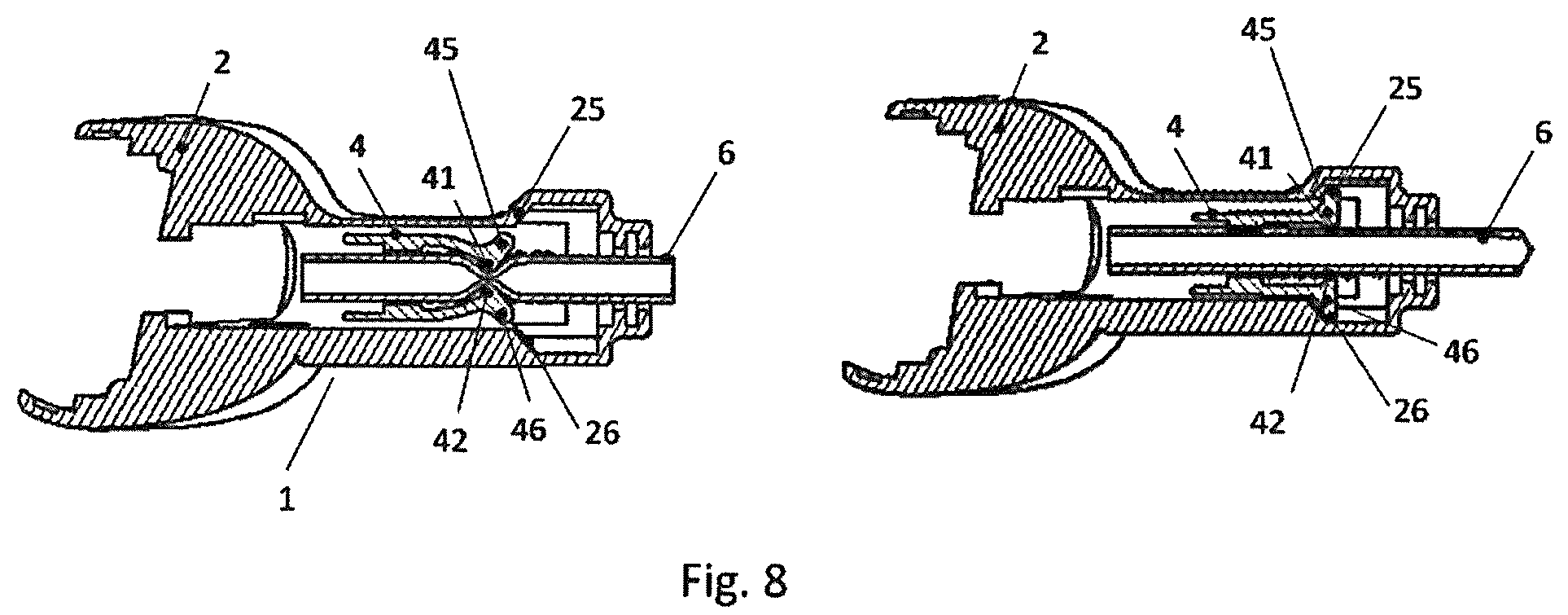 Patent US12472339 Figure 6 – Implantable access device for accessing the vascular system of a human or animal body, particularly subcutaneously implantable access port