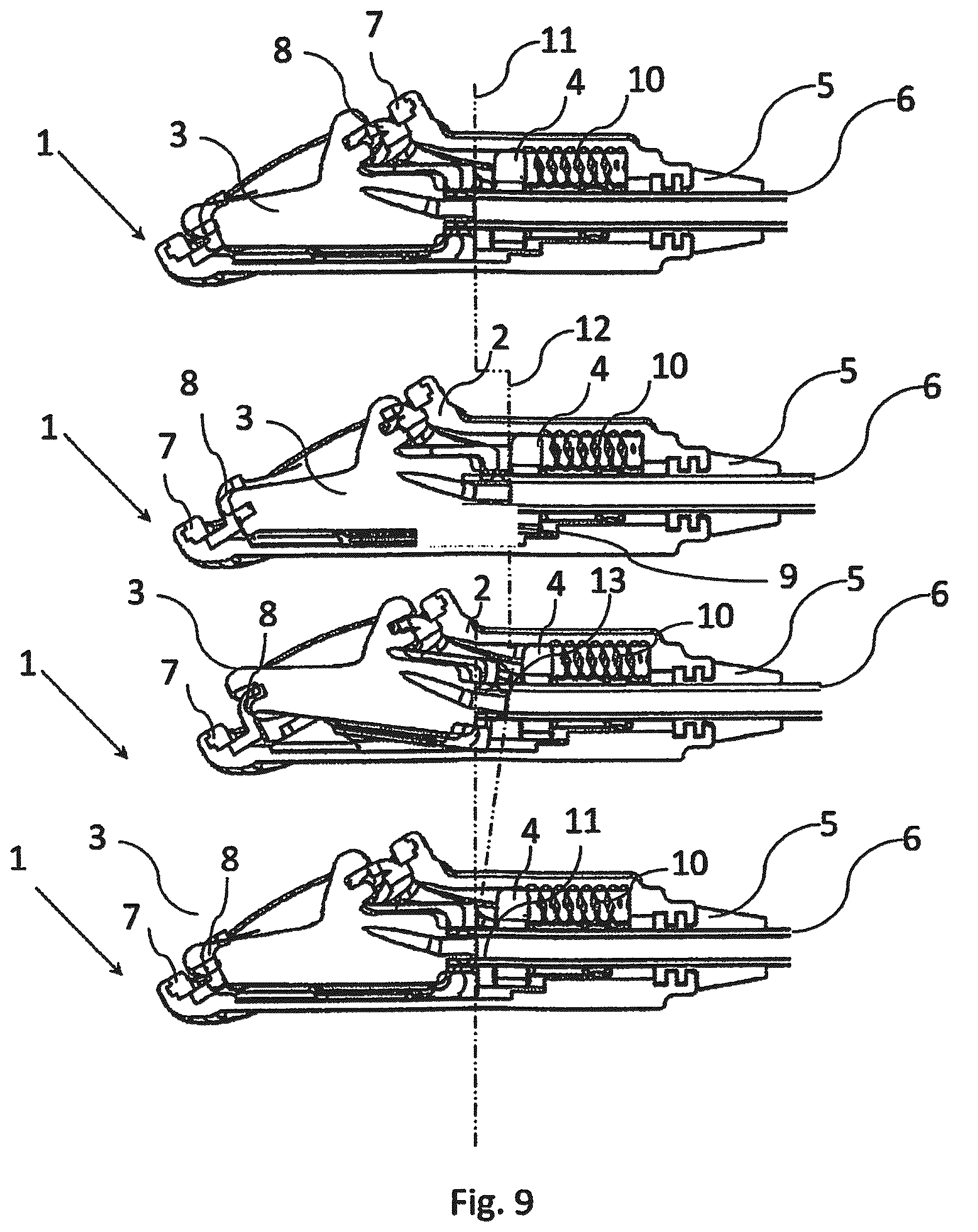 Patent US12472339 Figure 7 – Implantable access device for accessing the vascular system of a human or animal body, particularly subcutaneously implantable access port