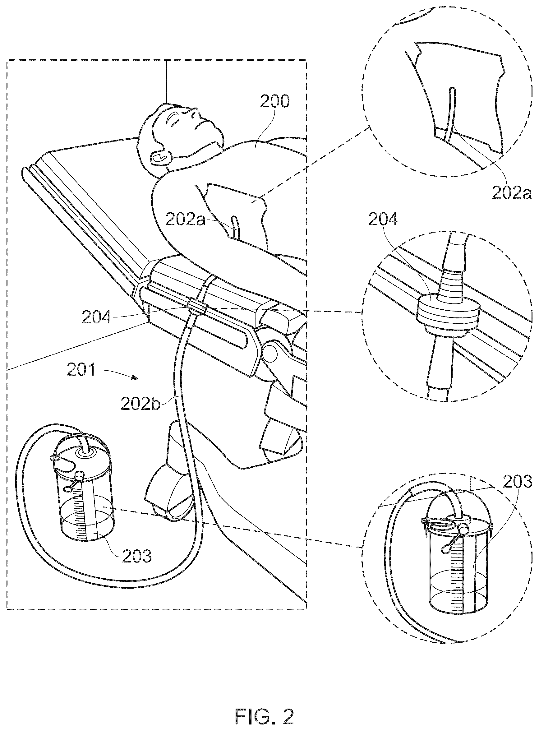 Patent US12472341 Figure 2 – Chest drain connector