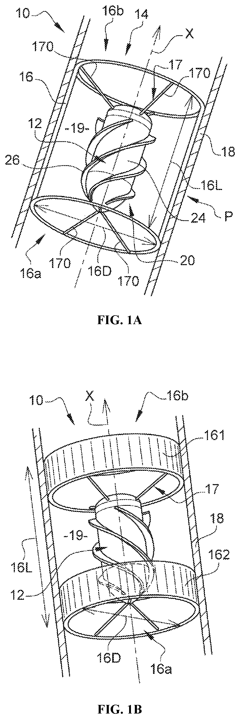 Patent US12472344 Figure 1 – Left ventricle unloading device