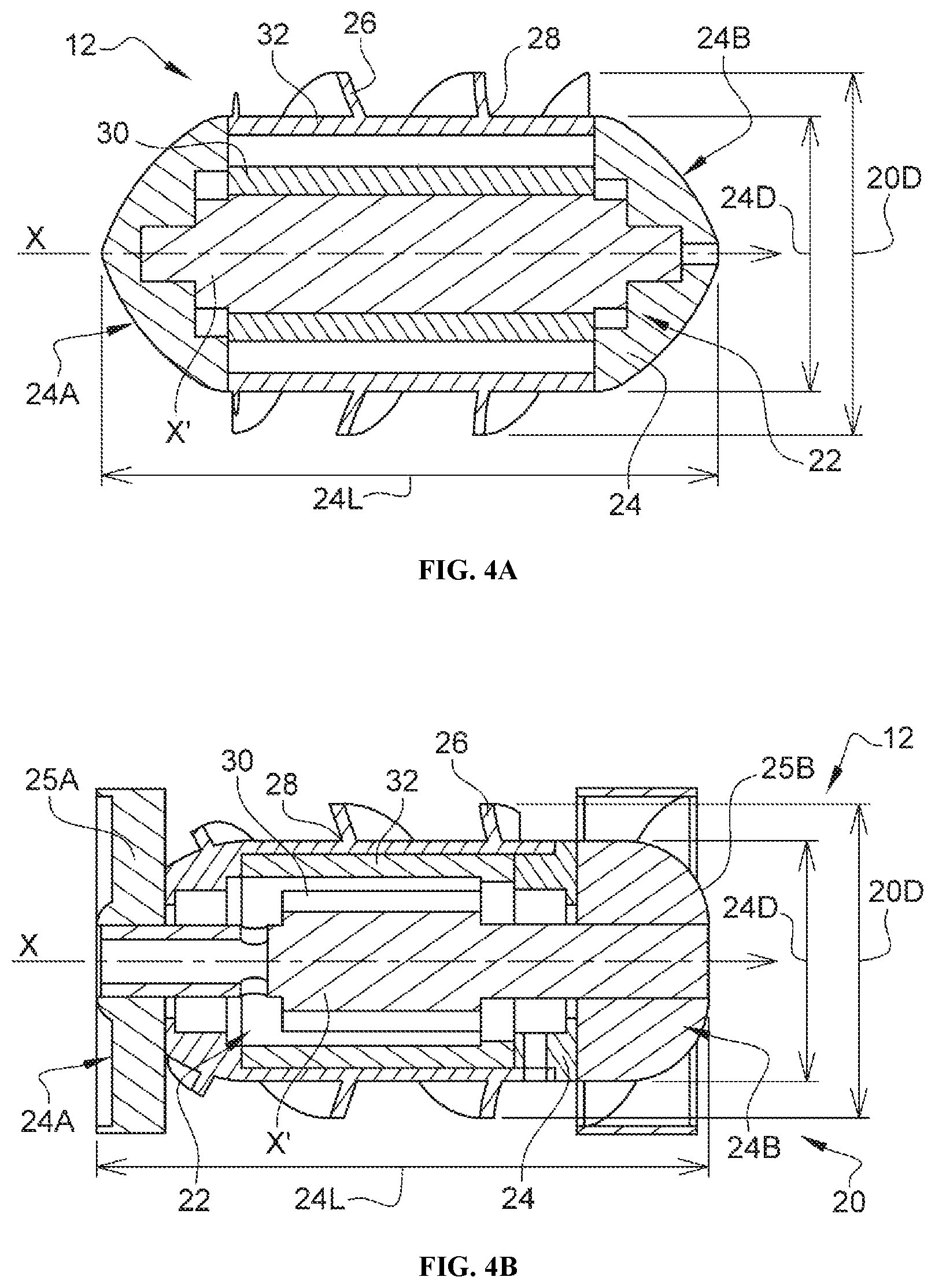 Patent US12472344 Figure 4 – Left ventricle unloading device