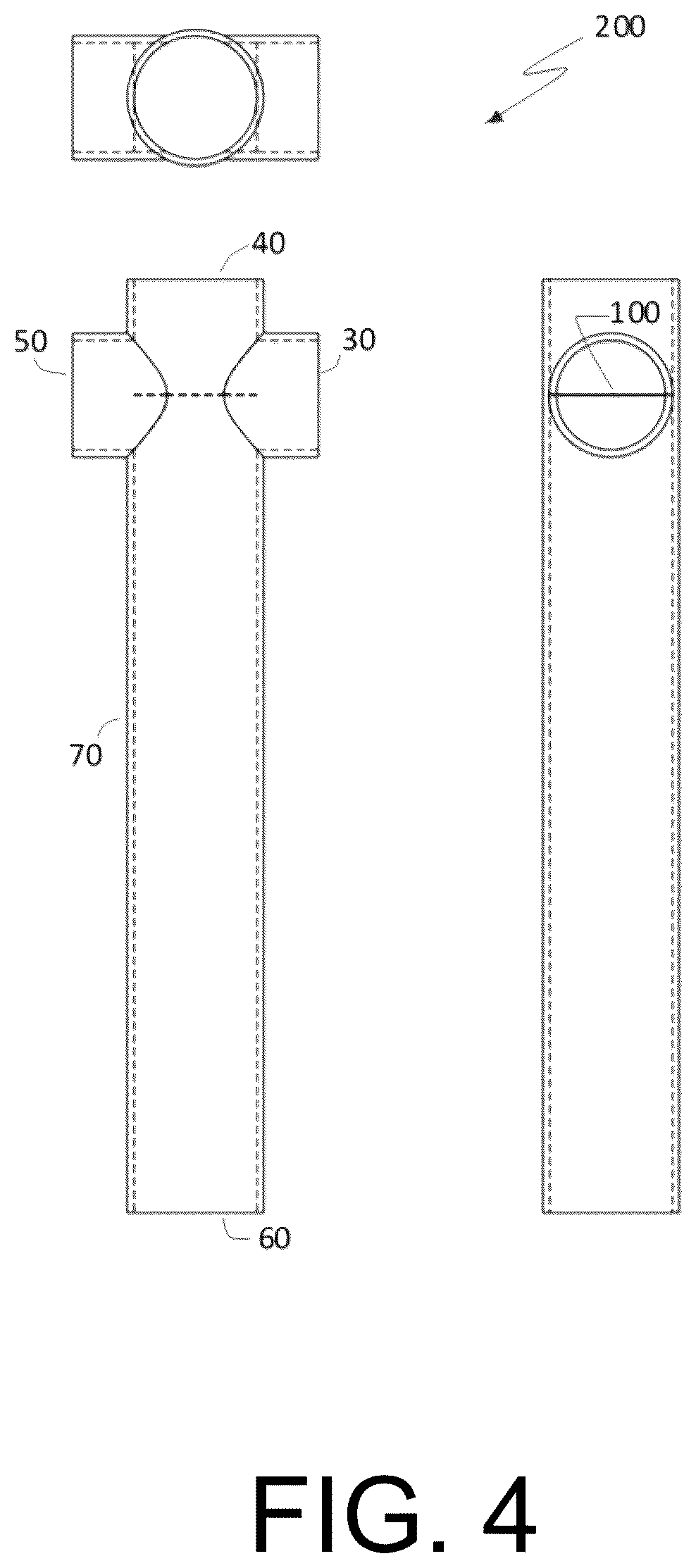 Patent US12472345 Figure 4 – Pulmonary circulation assist implant for a univentricular heart