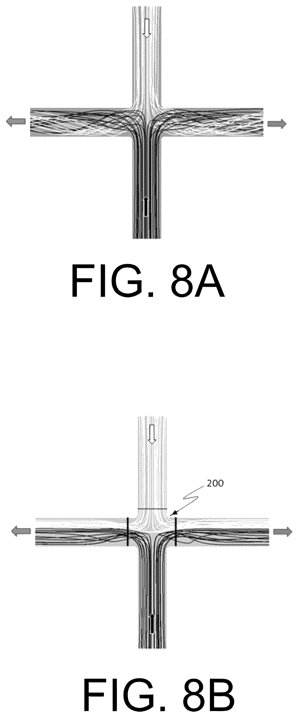 Patent US12472345 Figure 8 – Pulmonary circulation assist implant for a univentricular heart