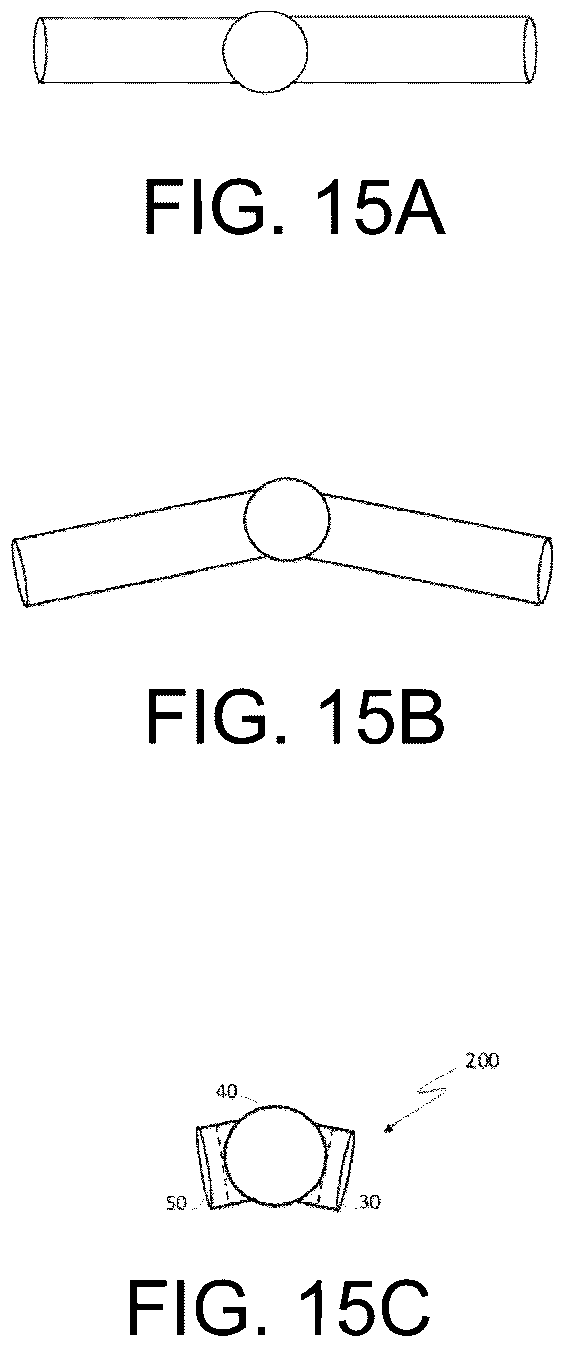 Patent US12472345 Figure 15 – Pulmonary circulation assist implant for a univentricular heart