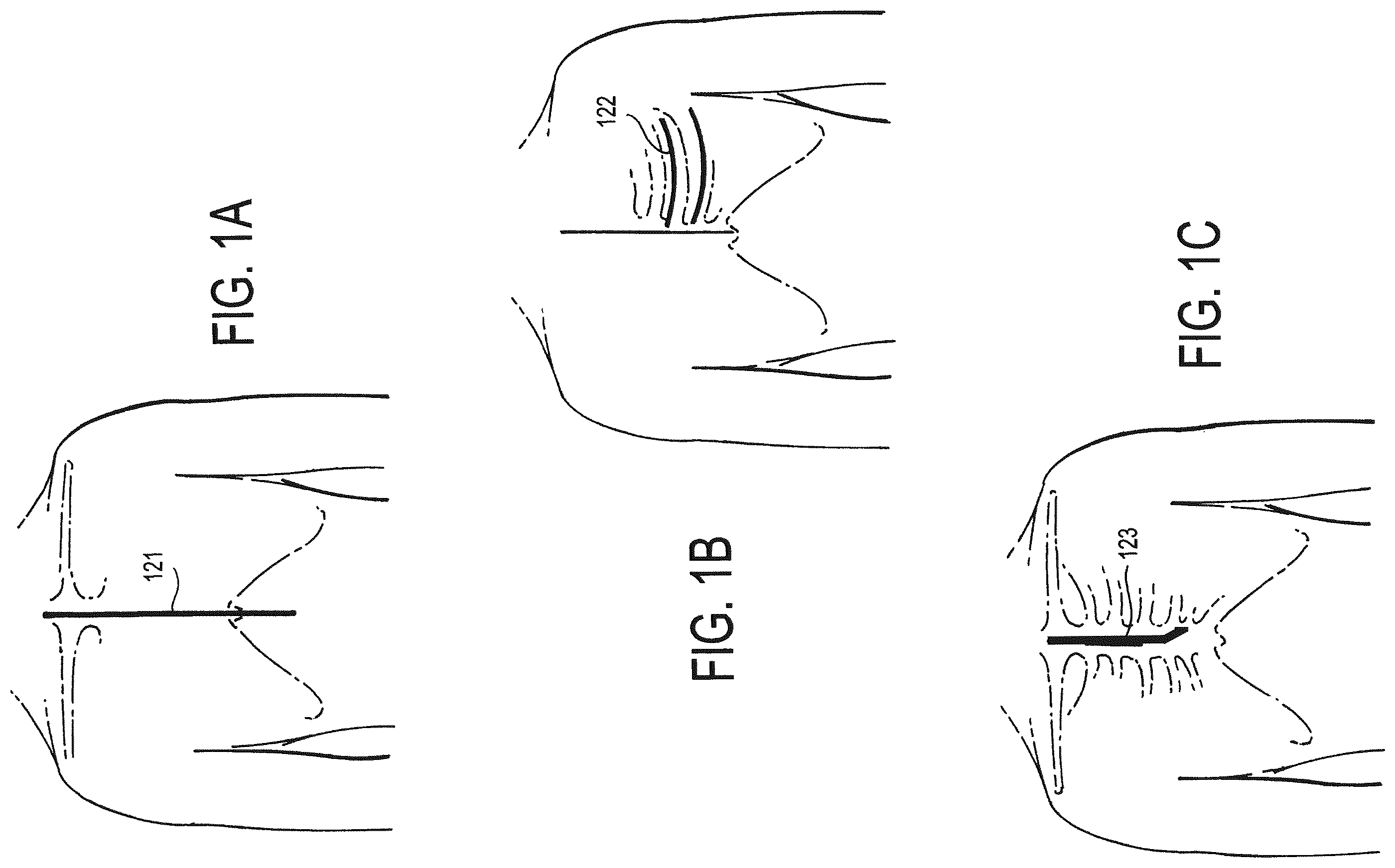 Patent US12472346 Figure 1 – Configurable electrodes and sensors