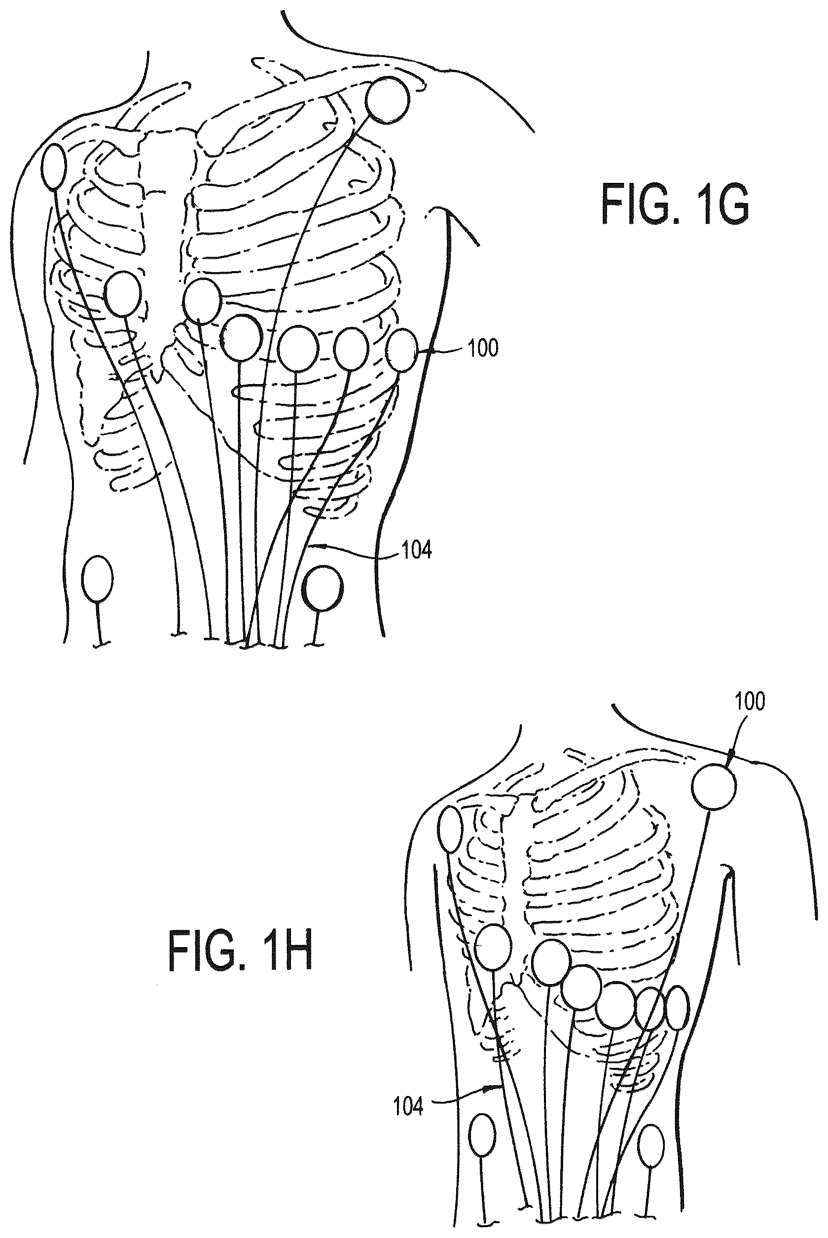 Patent US12472346 Figure 3 – Configurable electrodes and sensors