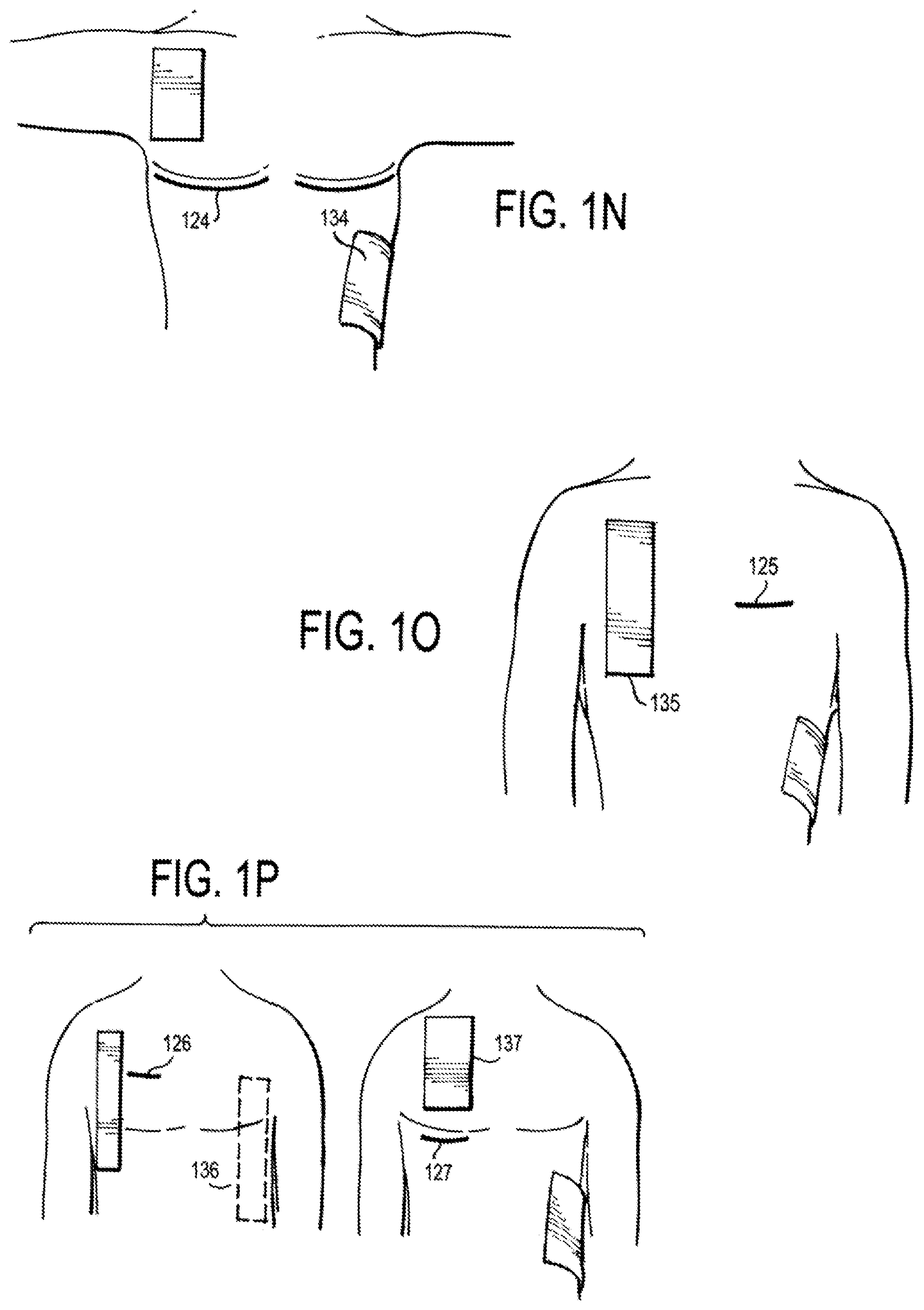 Patent US12472346 Figure 6 – Configurable electrodes and sensors