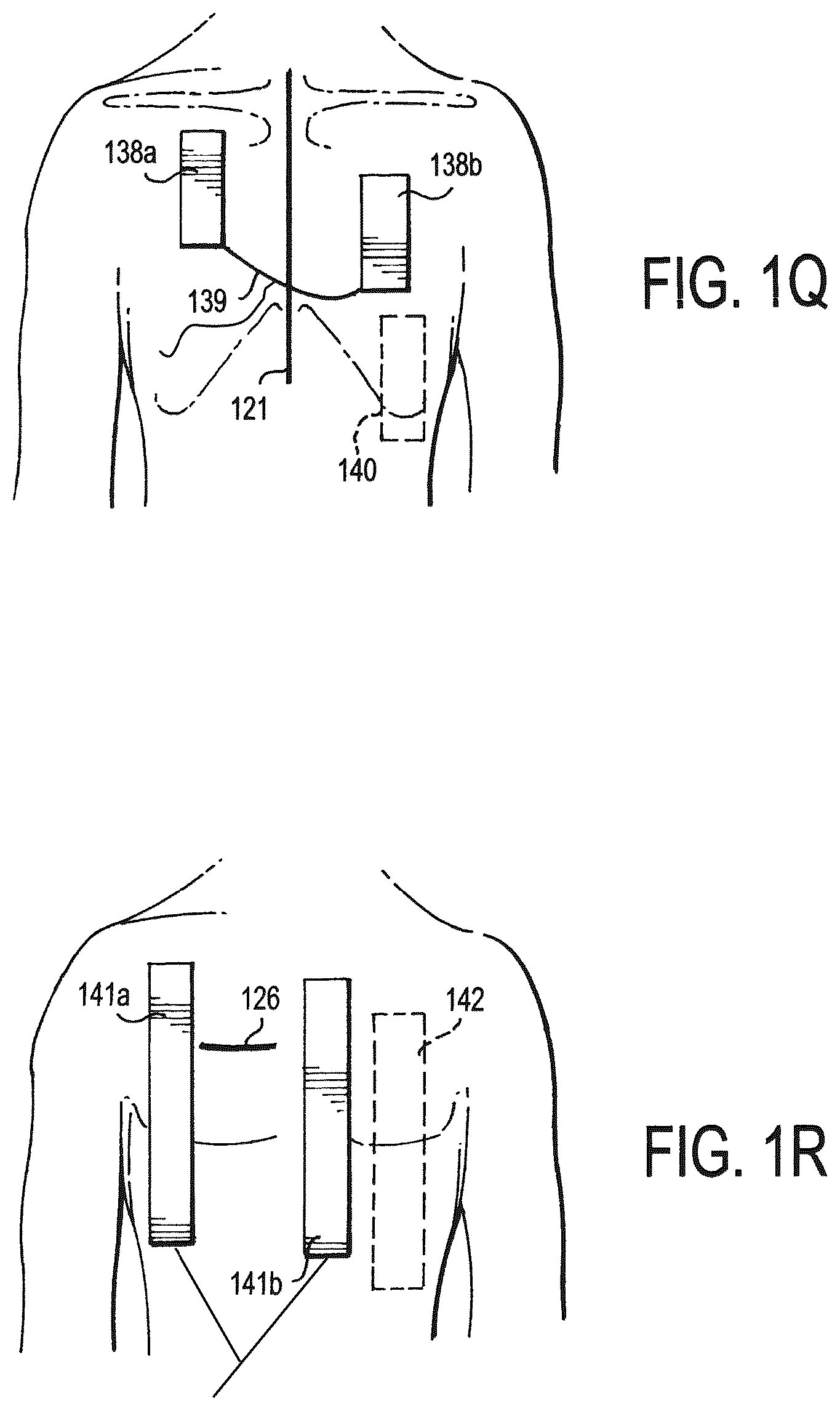 Patent US12472346 Figure 7 – Configurable electrodes and sensors