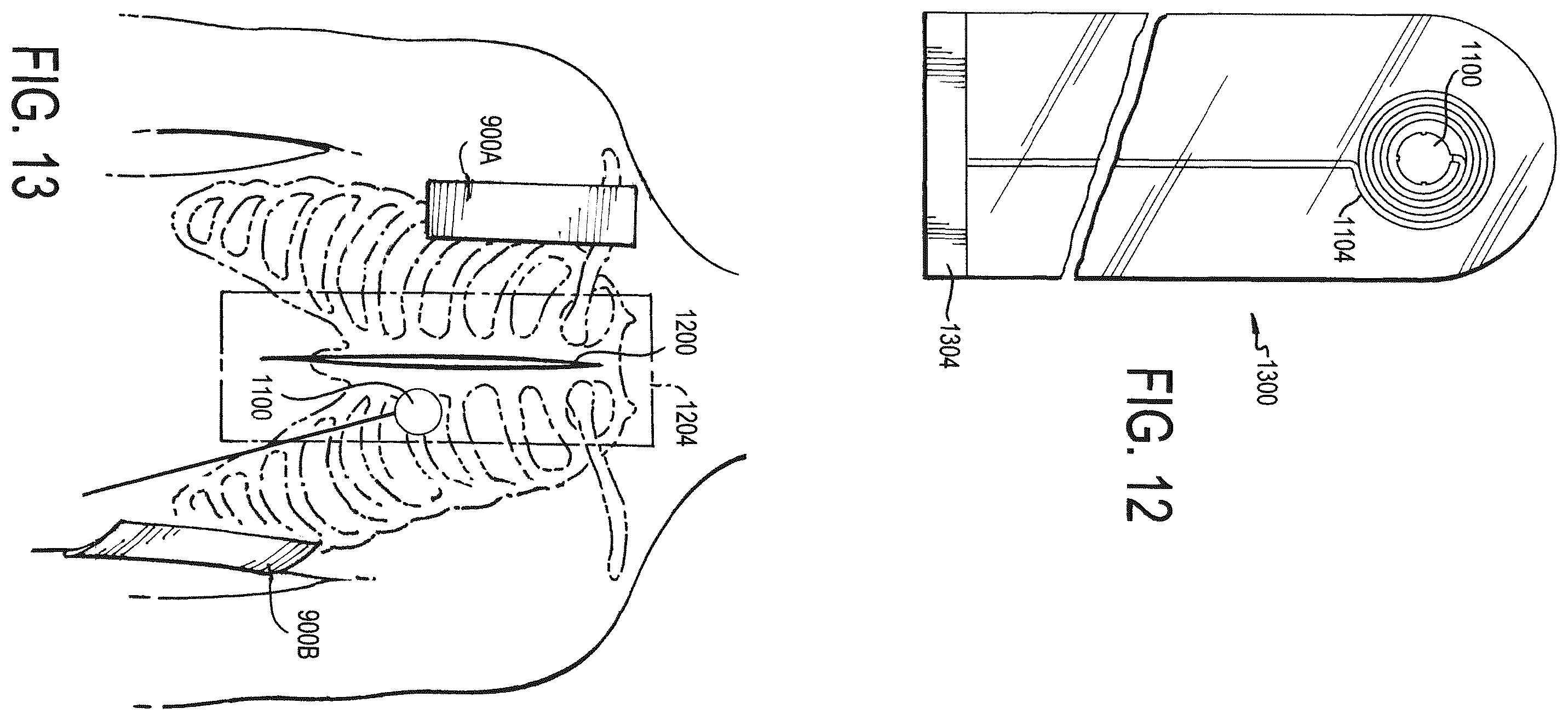 Patent US12472346 Figure 17 – Configurable electrodes and sensors