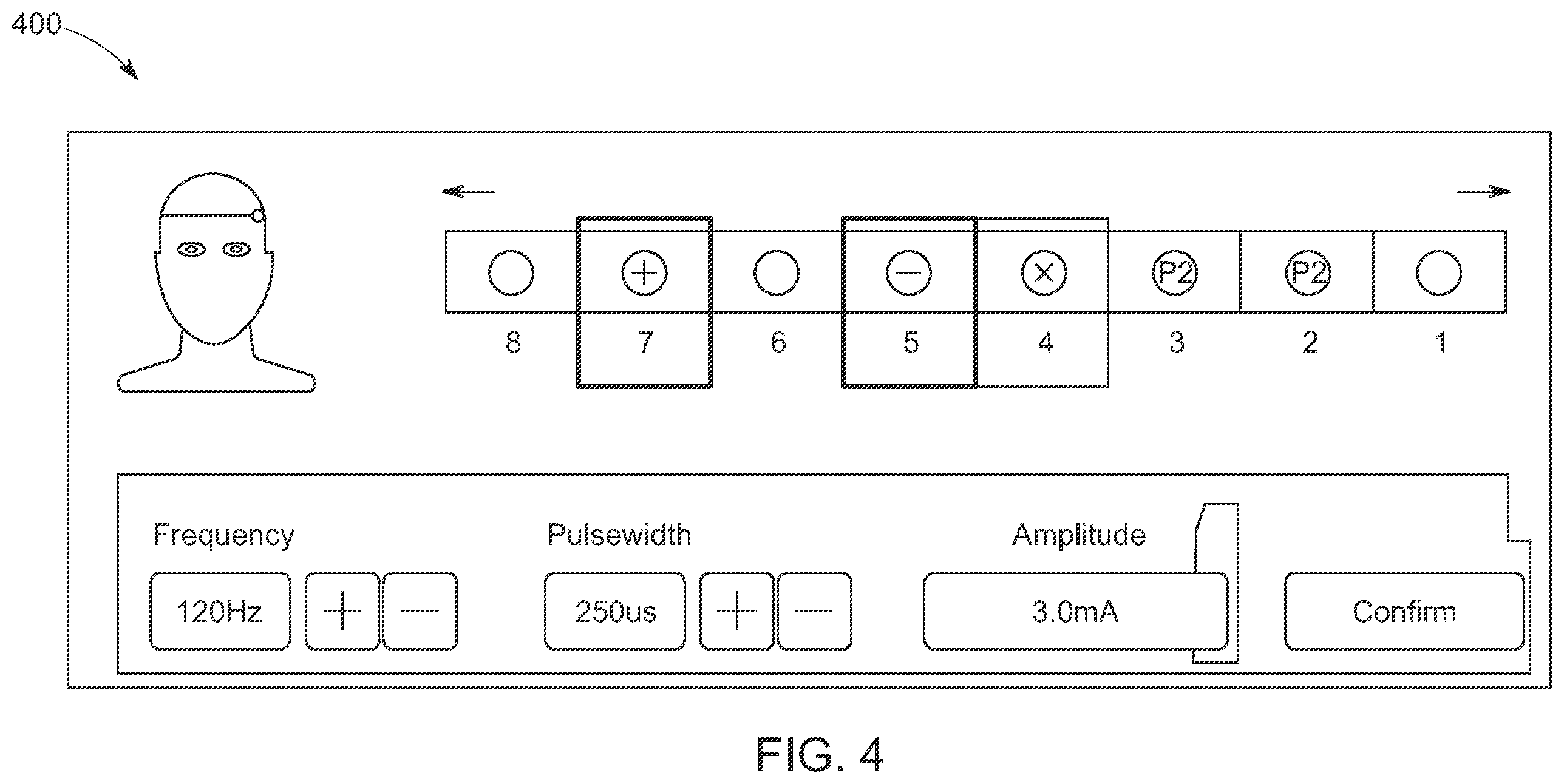Patent US12472347 Figure 4 – System and method for self-programming stimulation settings