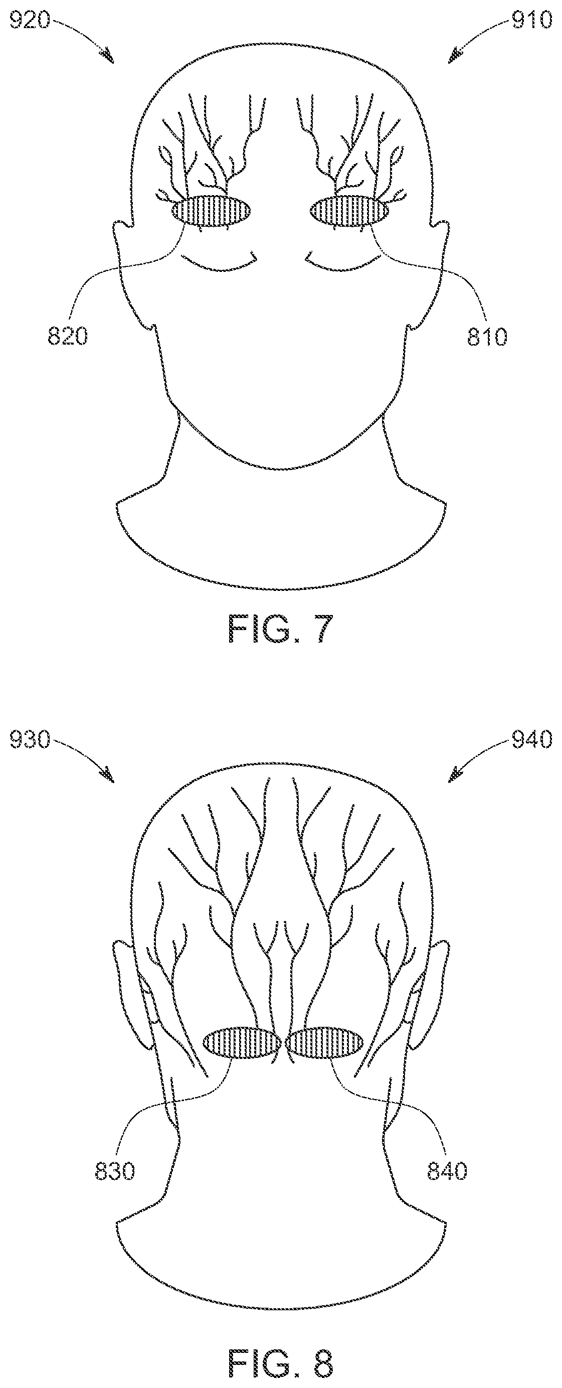 Patent US12472347 Figure 7 – System and method for self-programming stimulation settings
