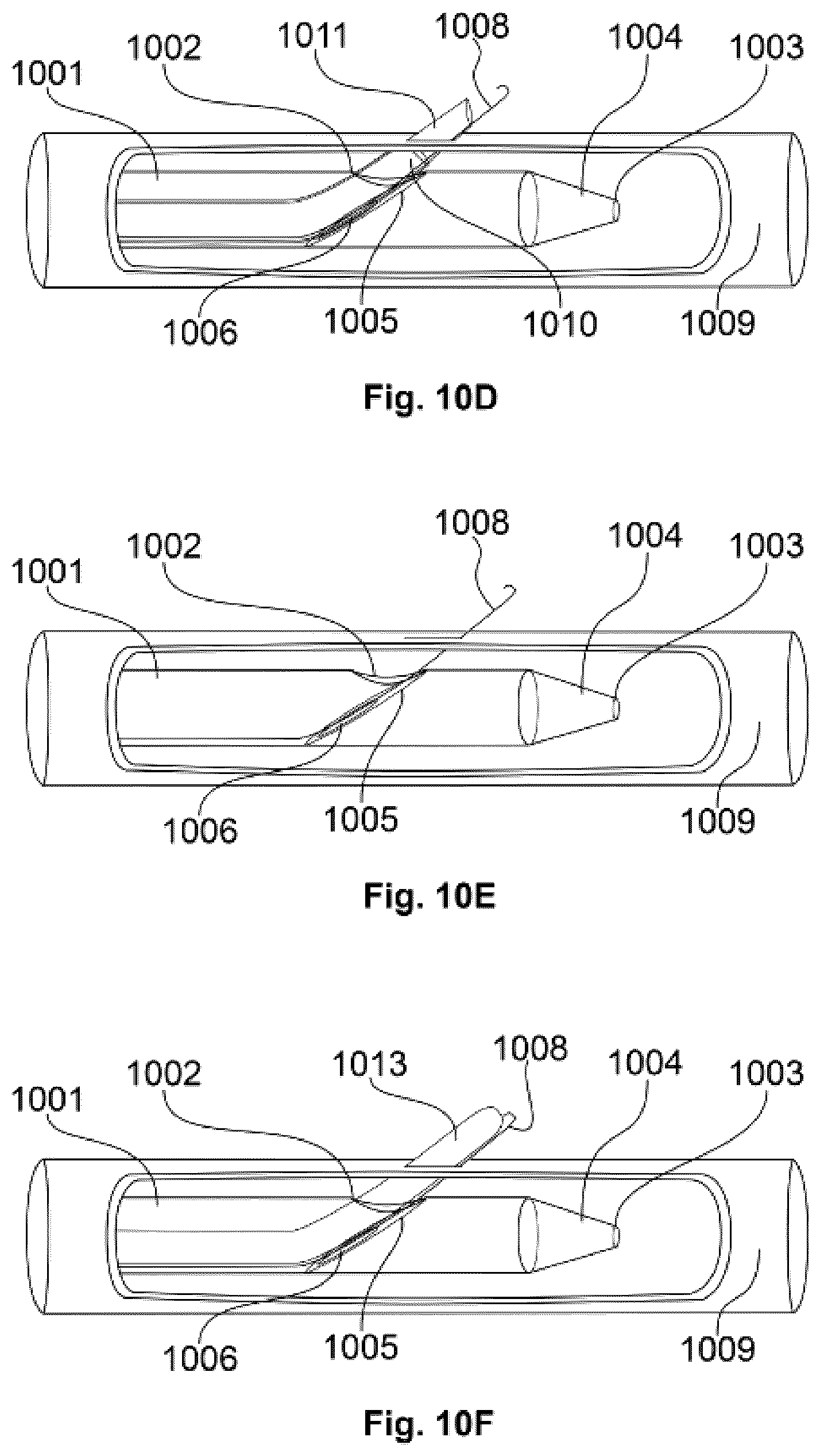 Patent US12472348 Figure 11 – Transcatheter electrode array and use thereof