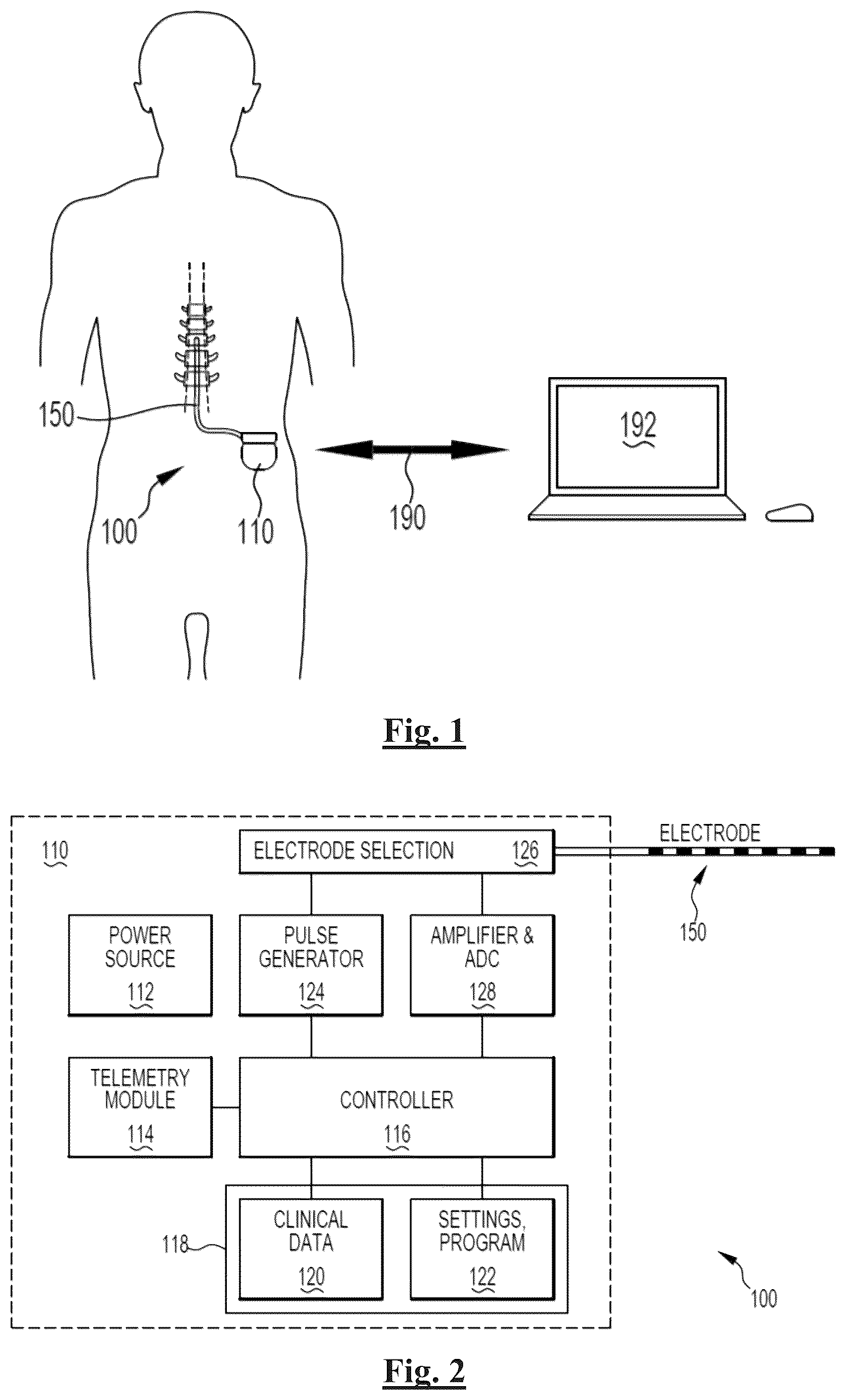 Patent US12472349 Figure 1 – Neurostimulation responsive to posture